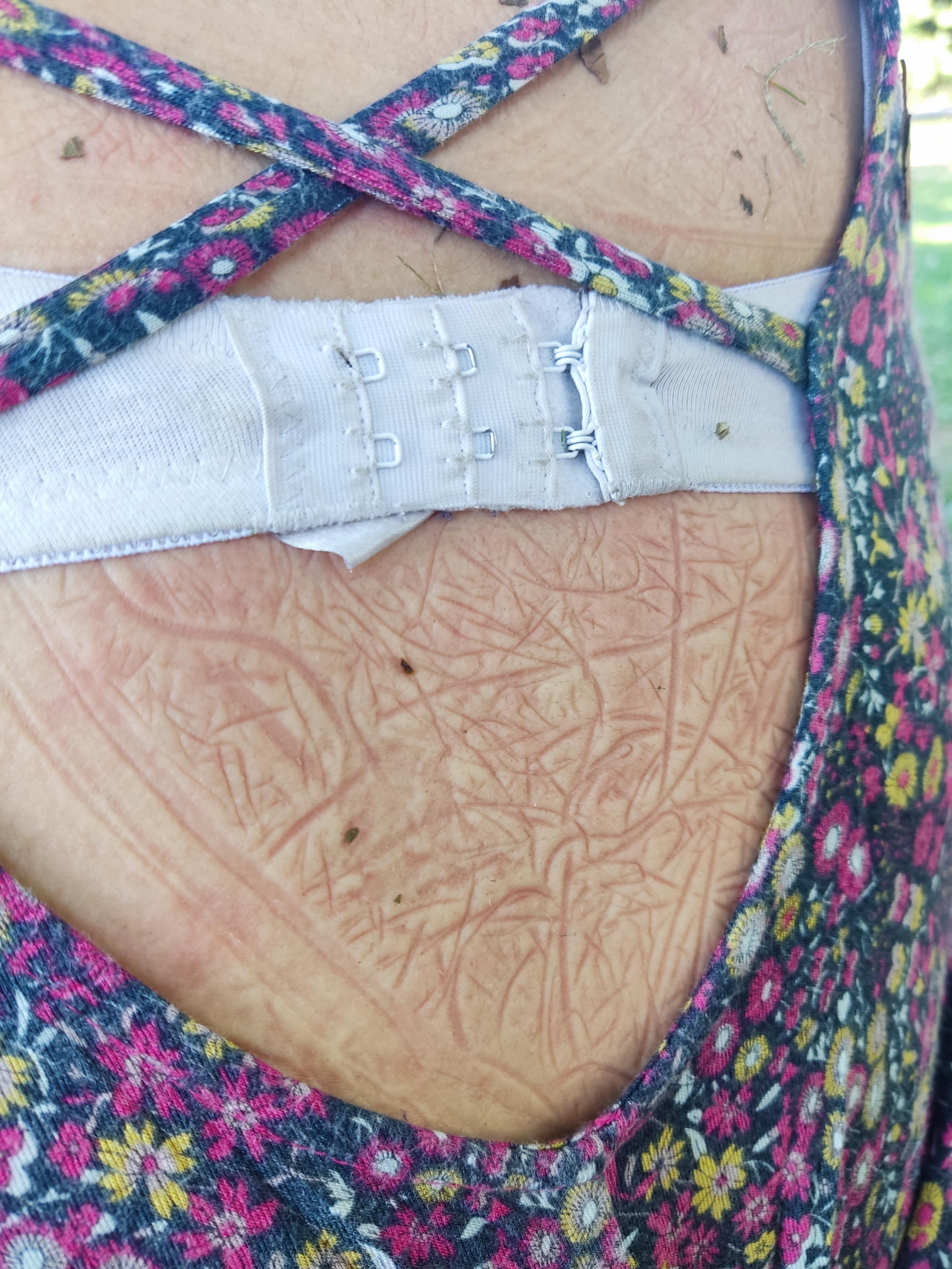 My friend's sleeping back Mark looks like a map r/mildlyinteresting