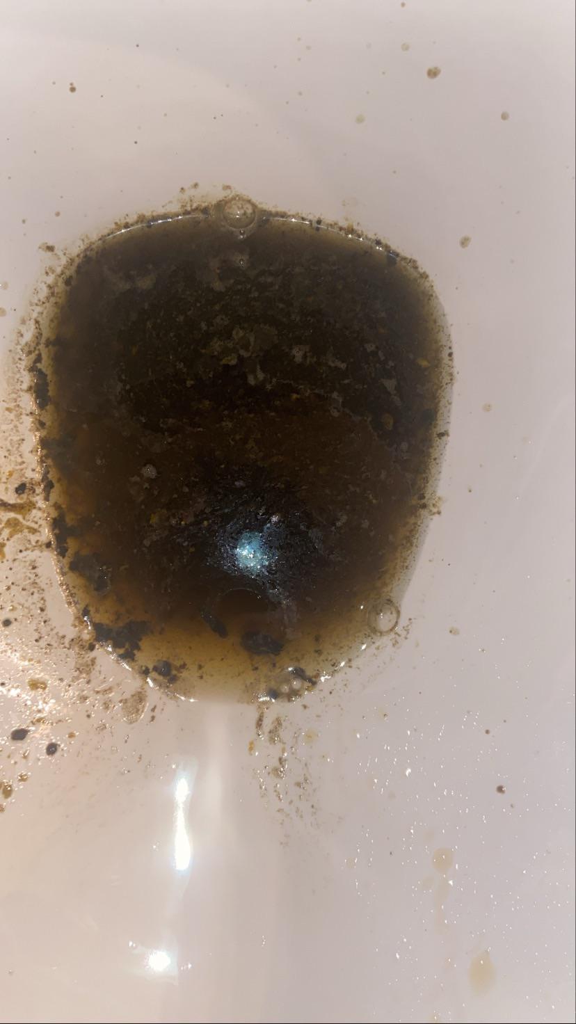 Guys I had bad food poisoning last night r/poop