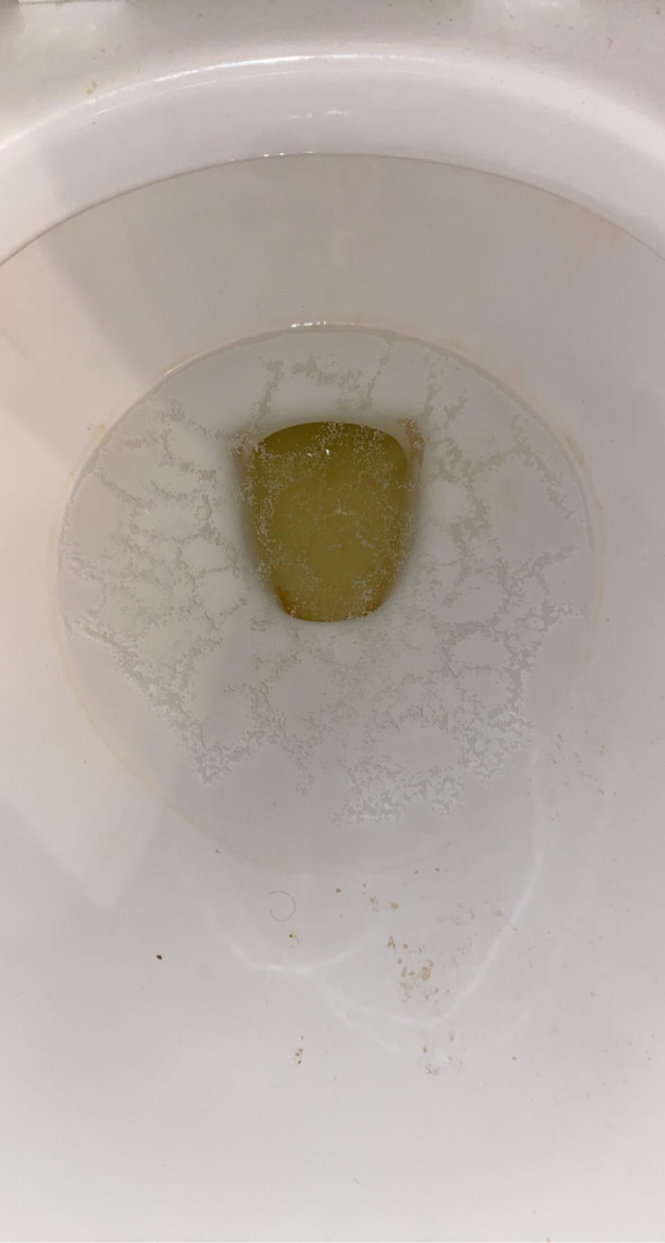 Urine With Semen Comes Out