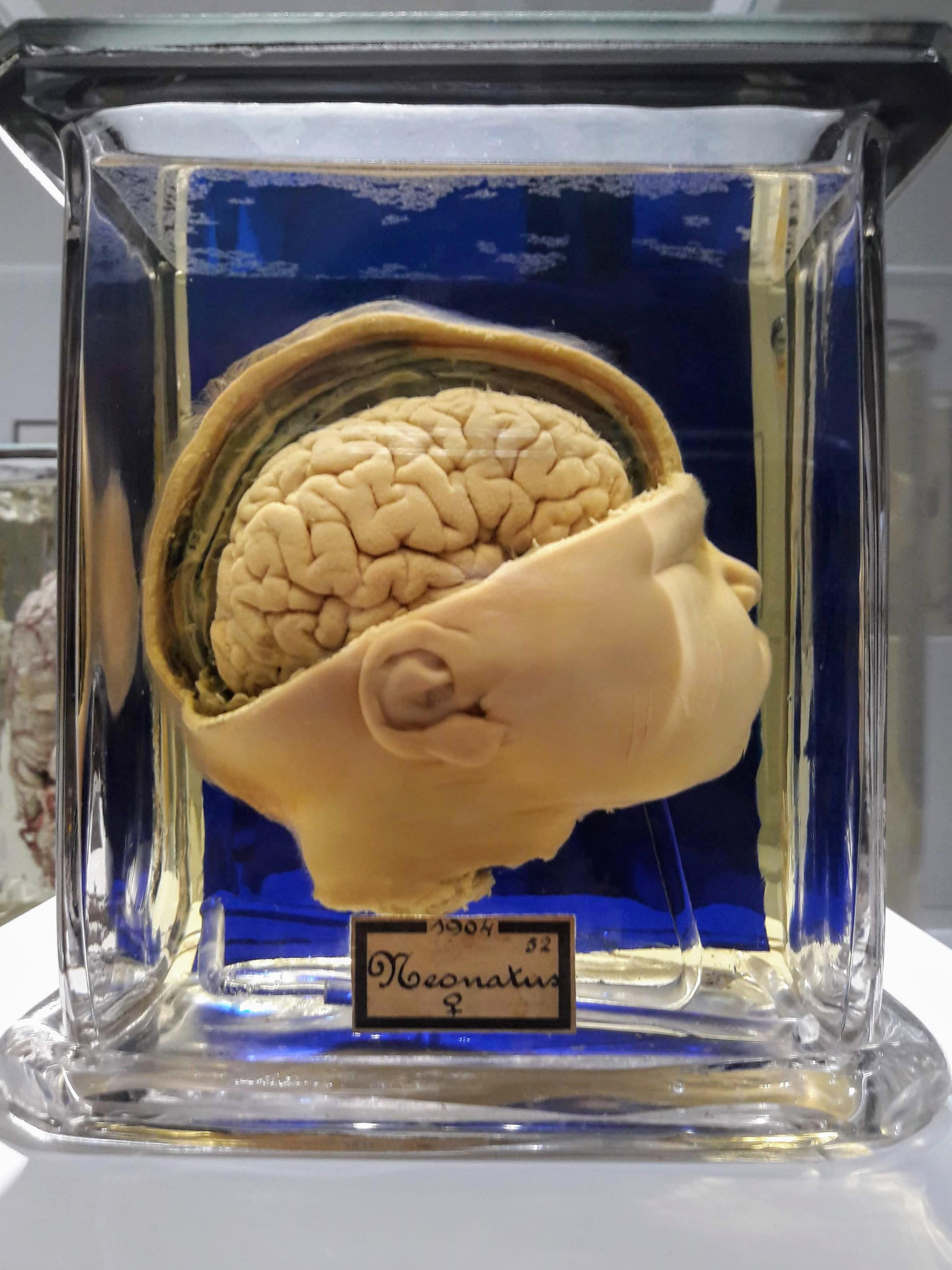 Baby in Formaldehyde, 1904. Collection Vrolik Museum, Amsterdam. r