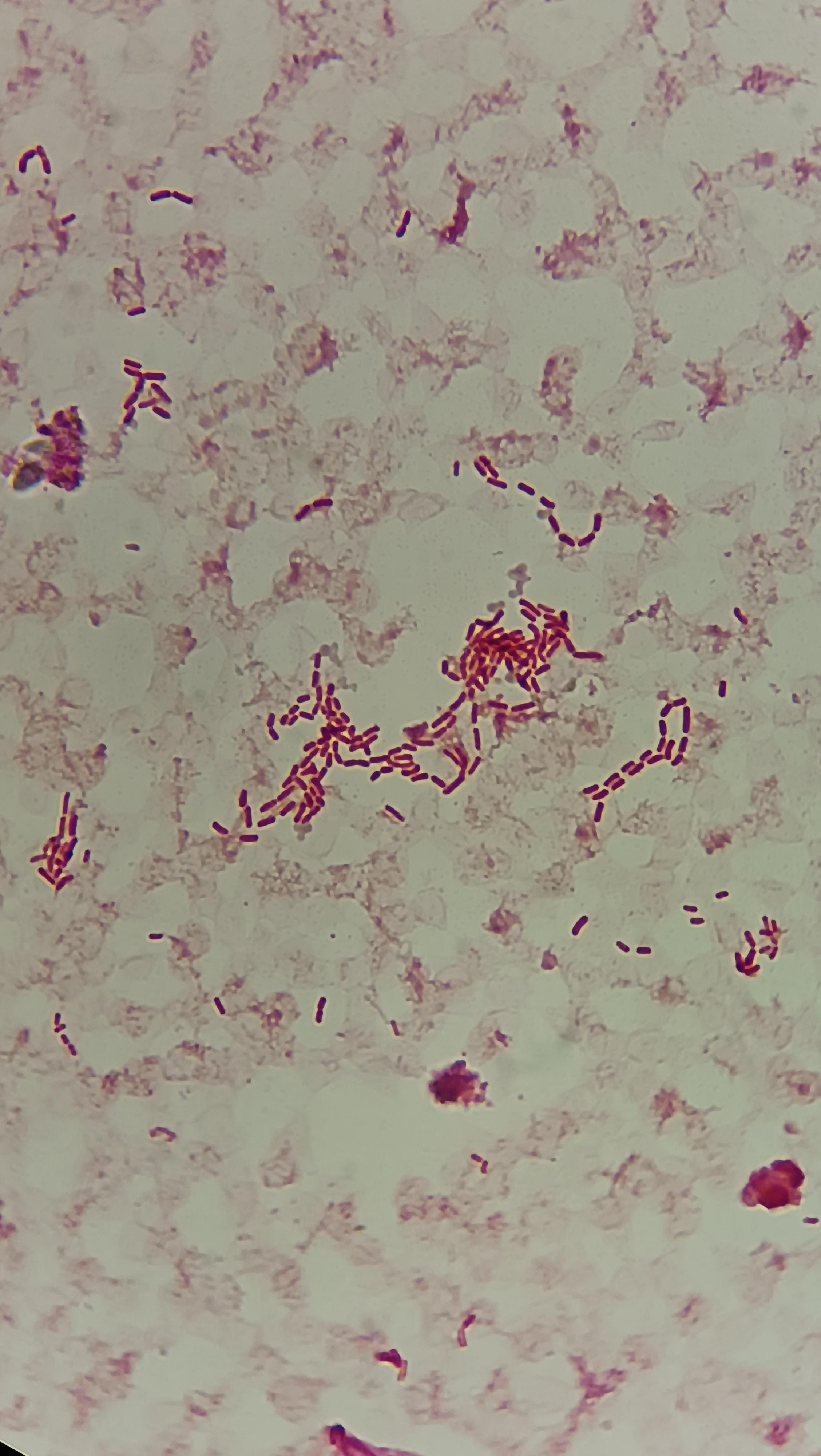 Gram negative bacilli found in a blood culture r/microbiology