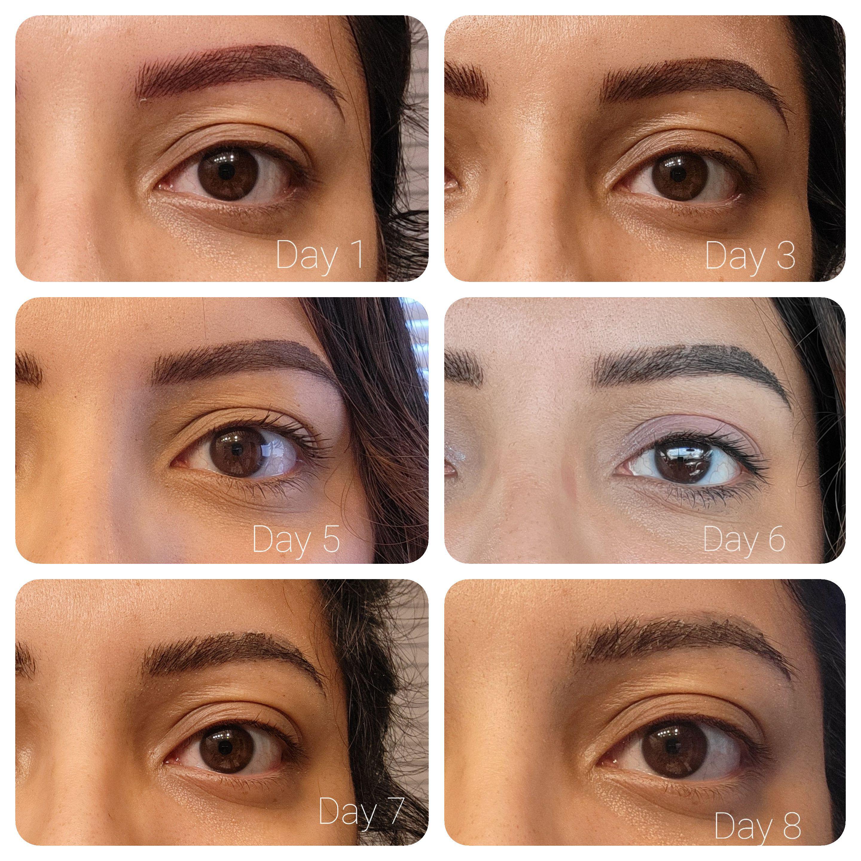 A little update of my healing process. Currently on day 8! 😊 r