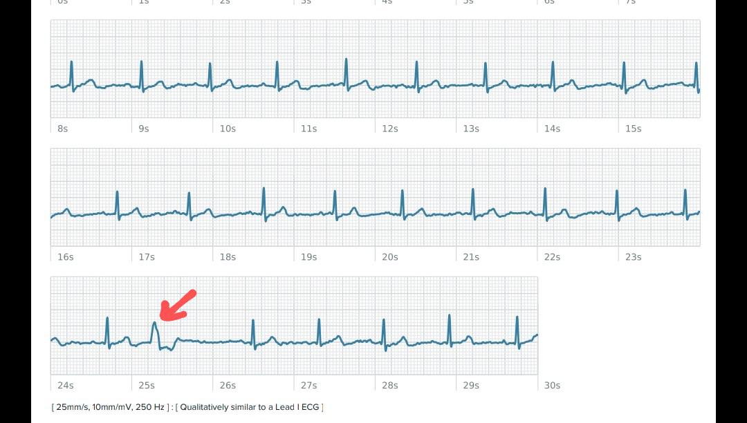 Does this look like a regular PVC? Used to having them. Have been