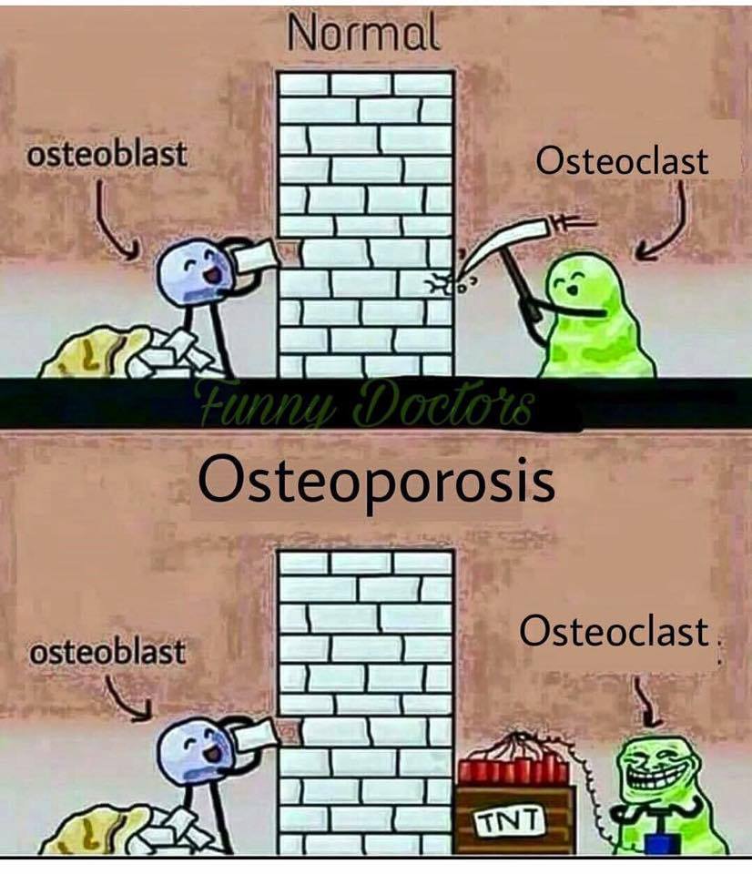 Perfect explanation of Osteoporosis r/medizzy