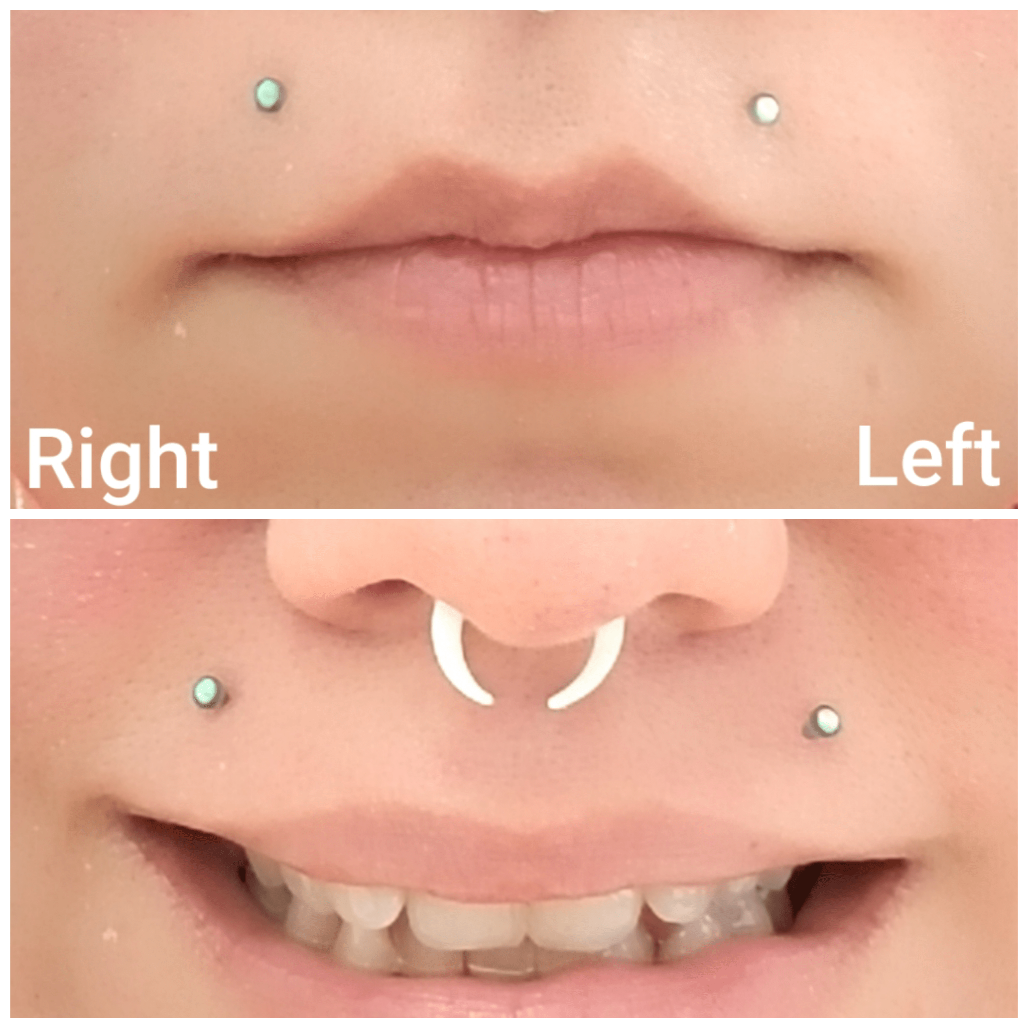 I got Angel bites 5 months ago, and they seem crooked to me. I've been