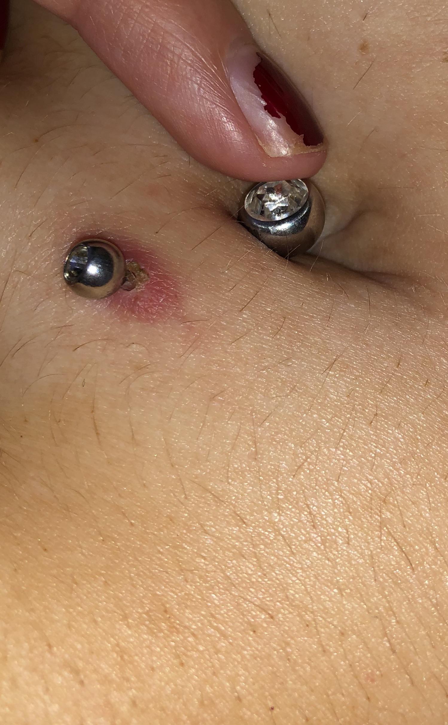 is my navel piercing infected? r/PiercingAdvice
