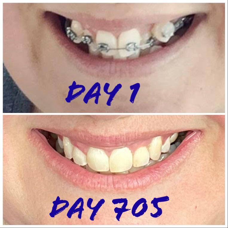 I did it!!! 705 days and many headaches later. It feels so strange but