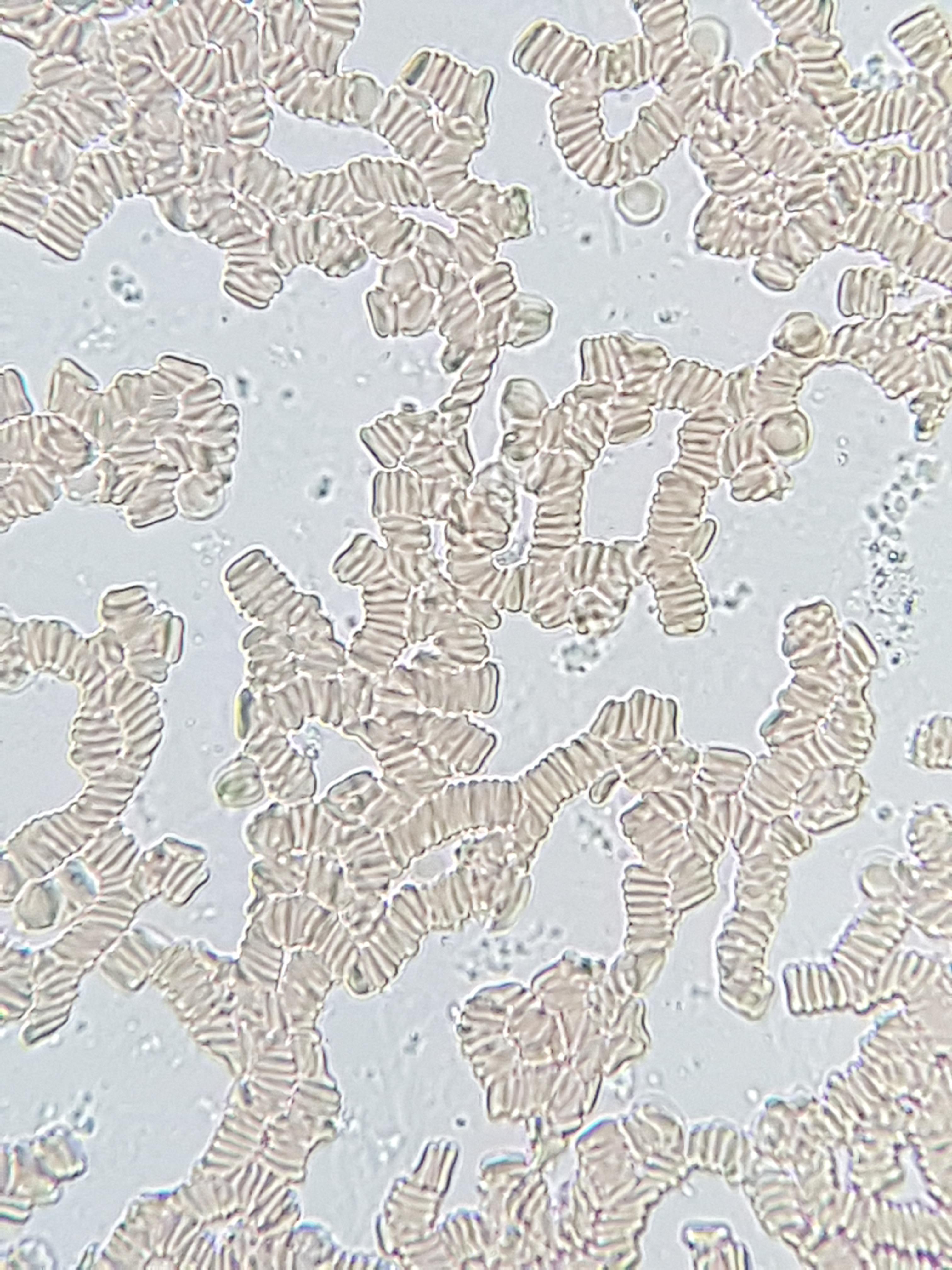 Surprising red blood cell rouleaux from a fresh blood sample from a KG