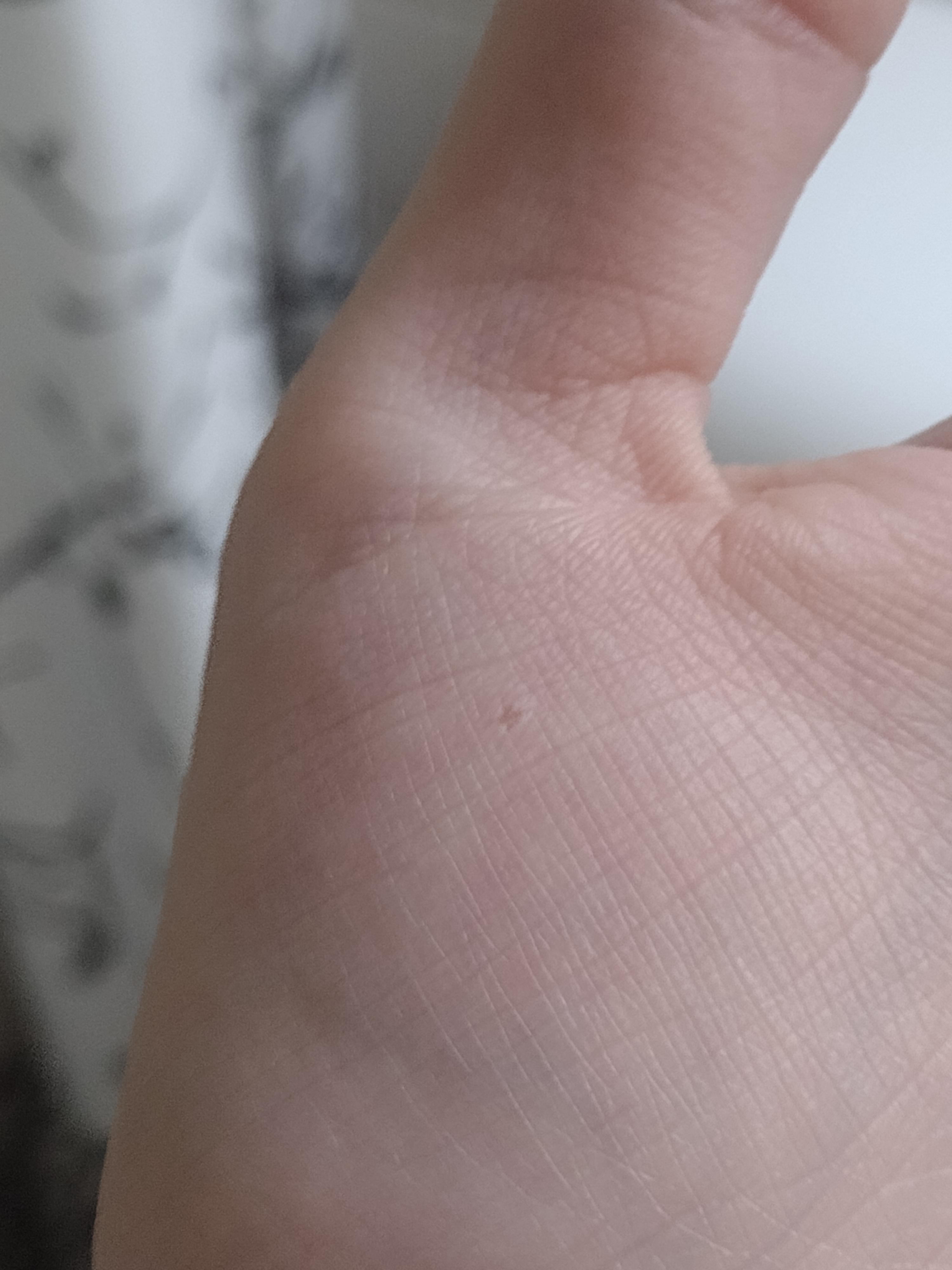 anyone have an idea of what the star shaped mark is? I've had it for