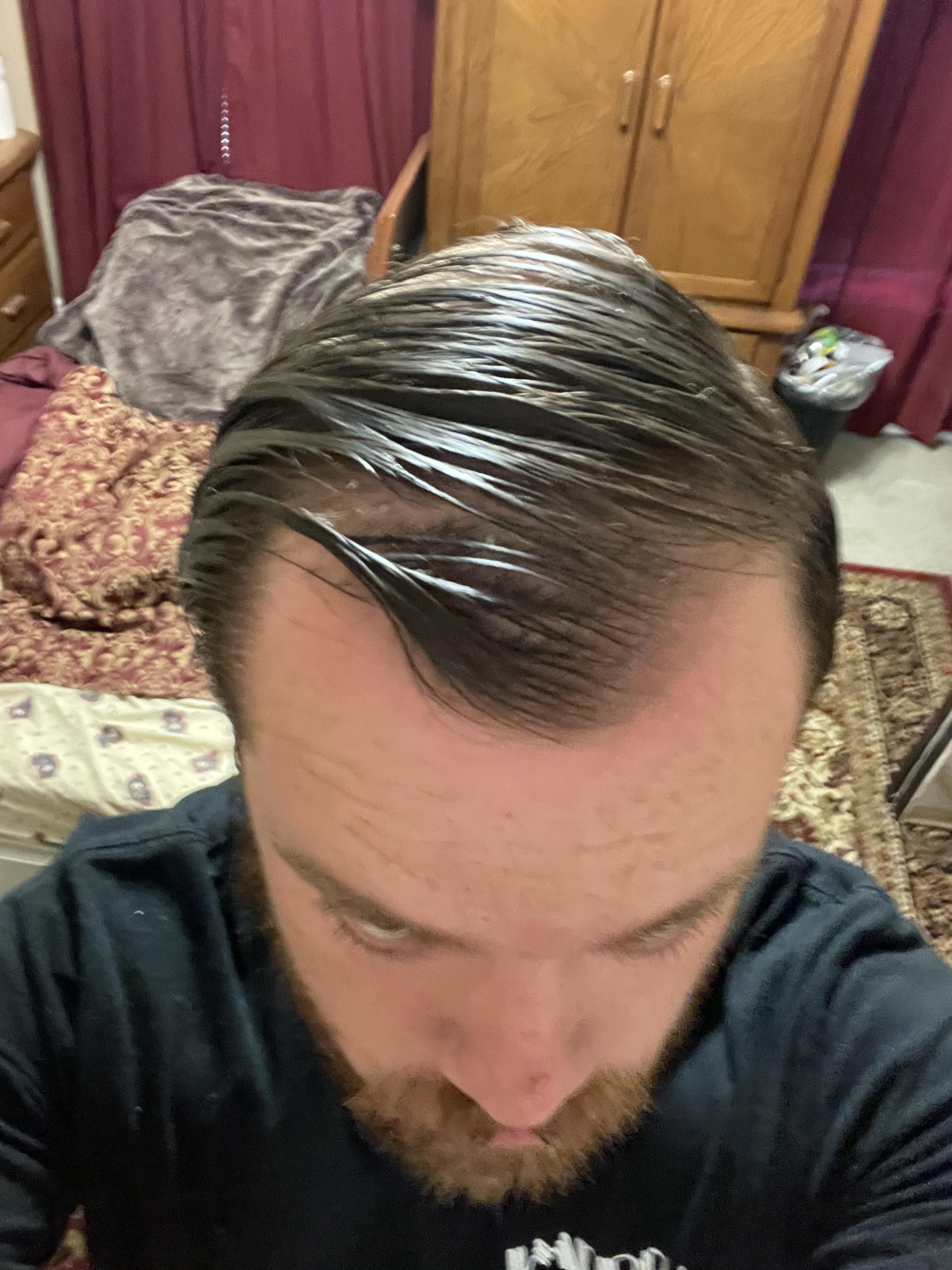 Is my hair thinning and is there a way to reverse it if it is? r
