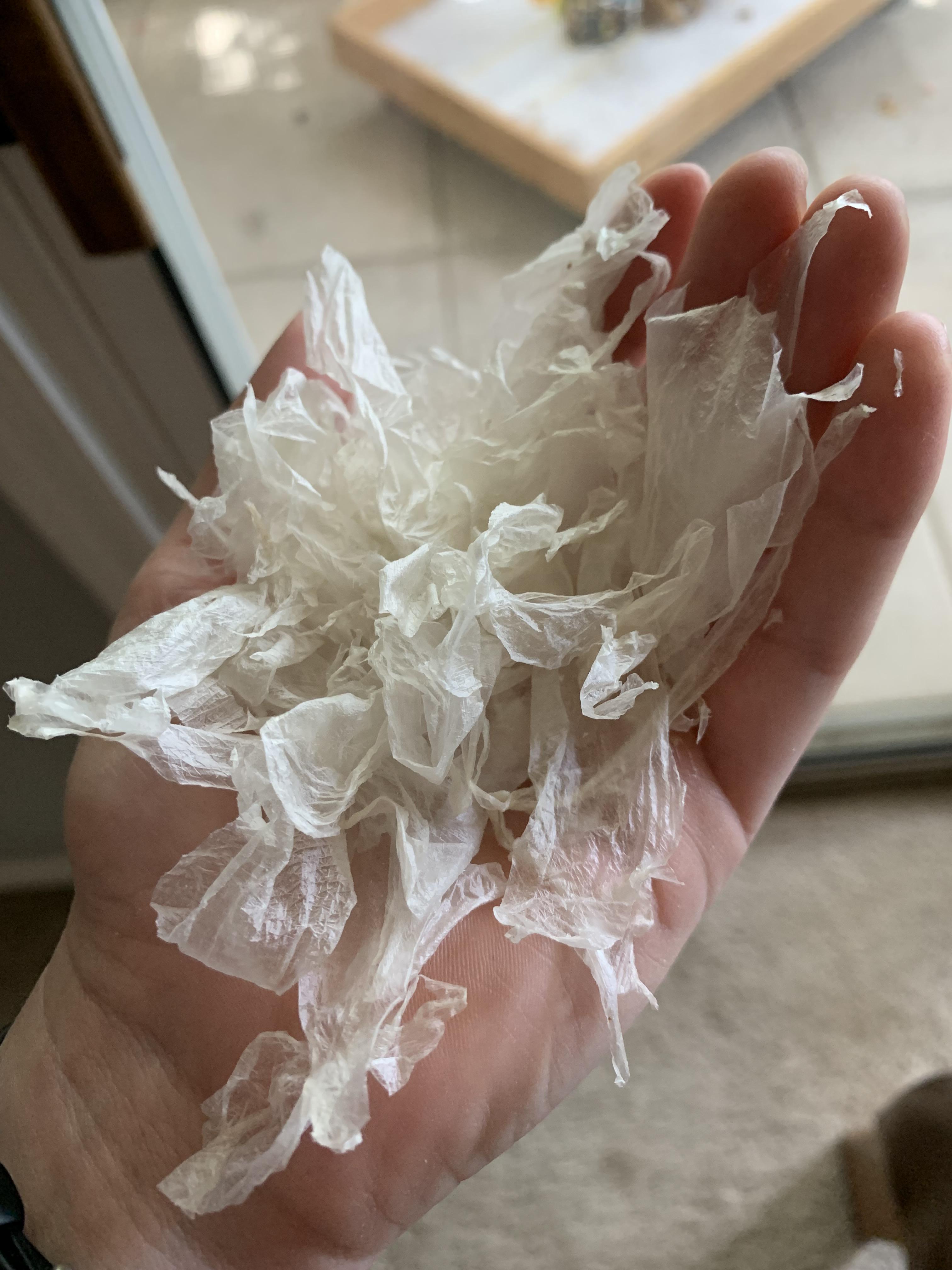 A let’s worth of my sunburn skin! r/peeling