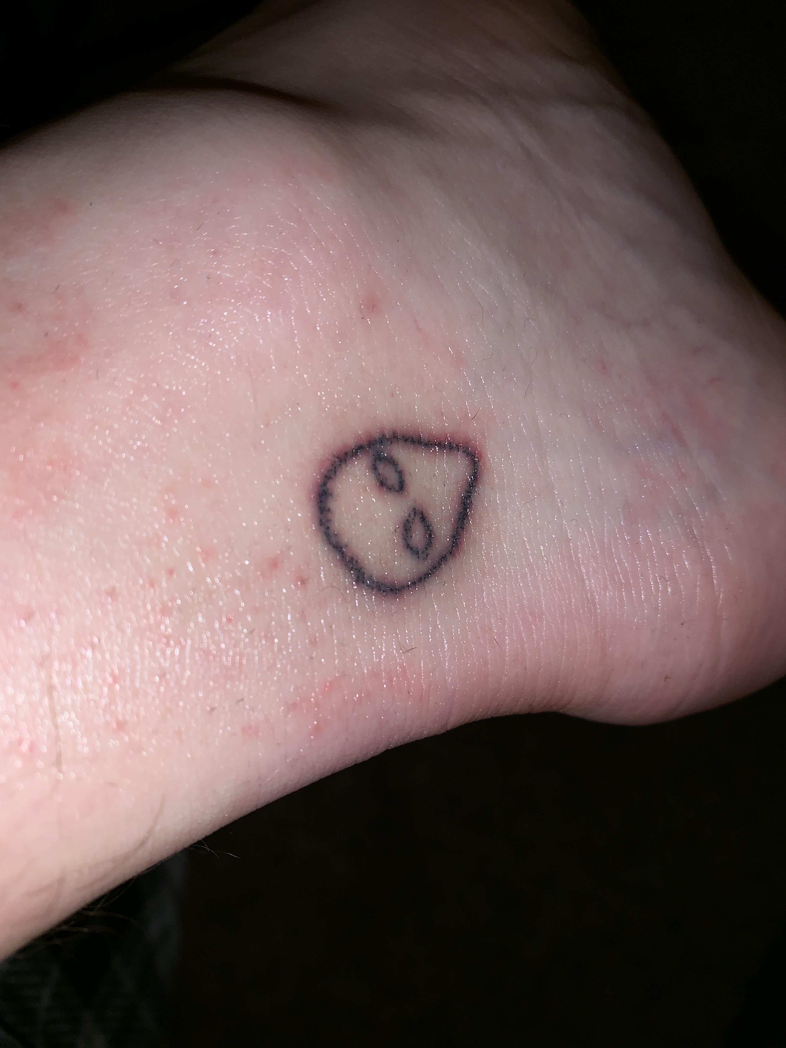 stick and poke tattoo, is it infected? i got it on 6/28. been washing