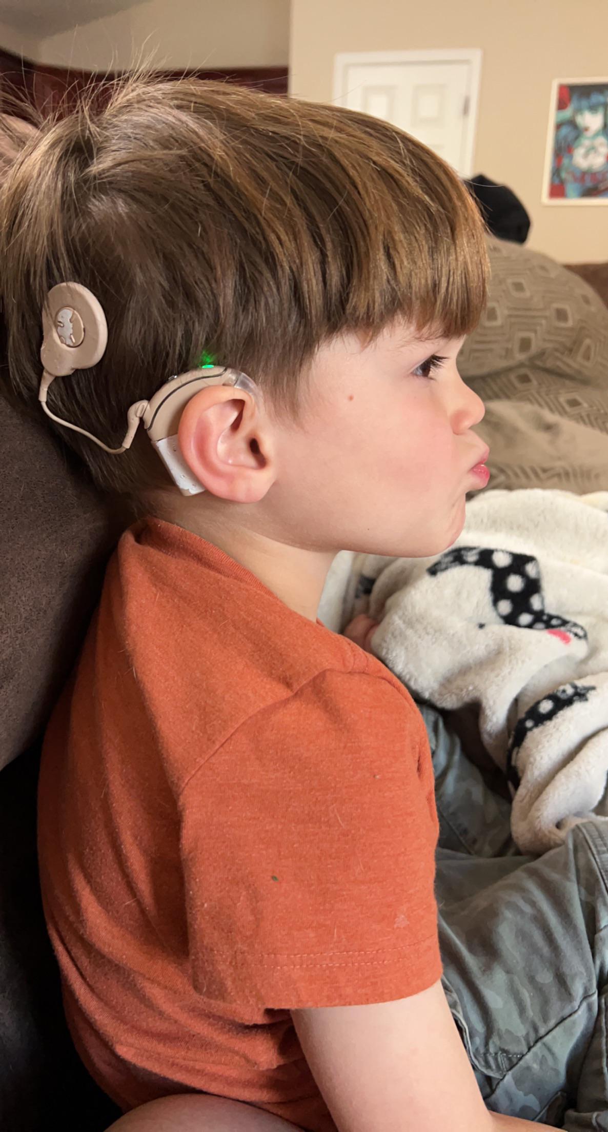 Choosing a Snugfit size : r/Cochlearimplants