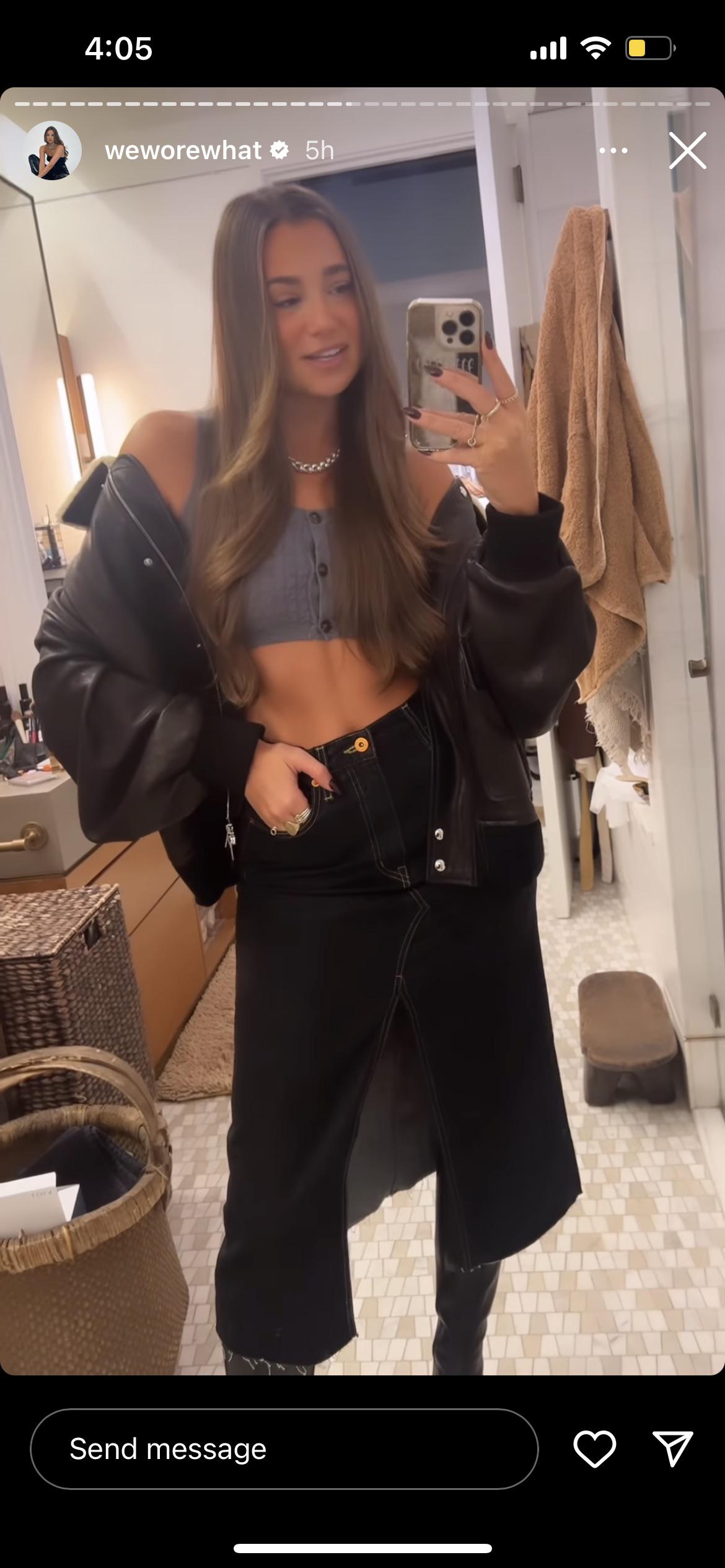 She is quite literally orange. Why does she think these spray tans look