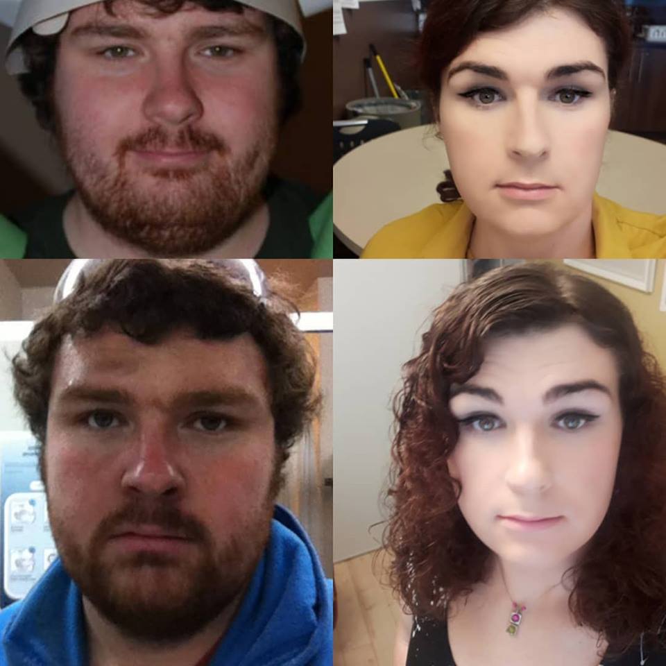 15 months HRT. not happy with the facial hair I have left from laser