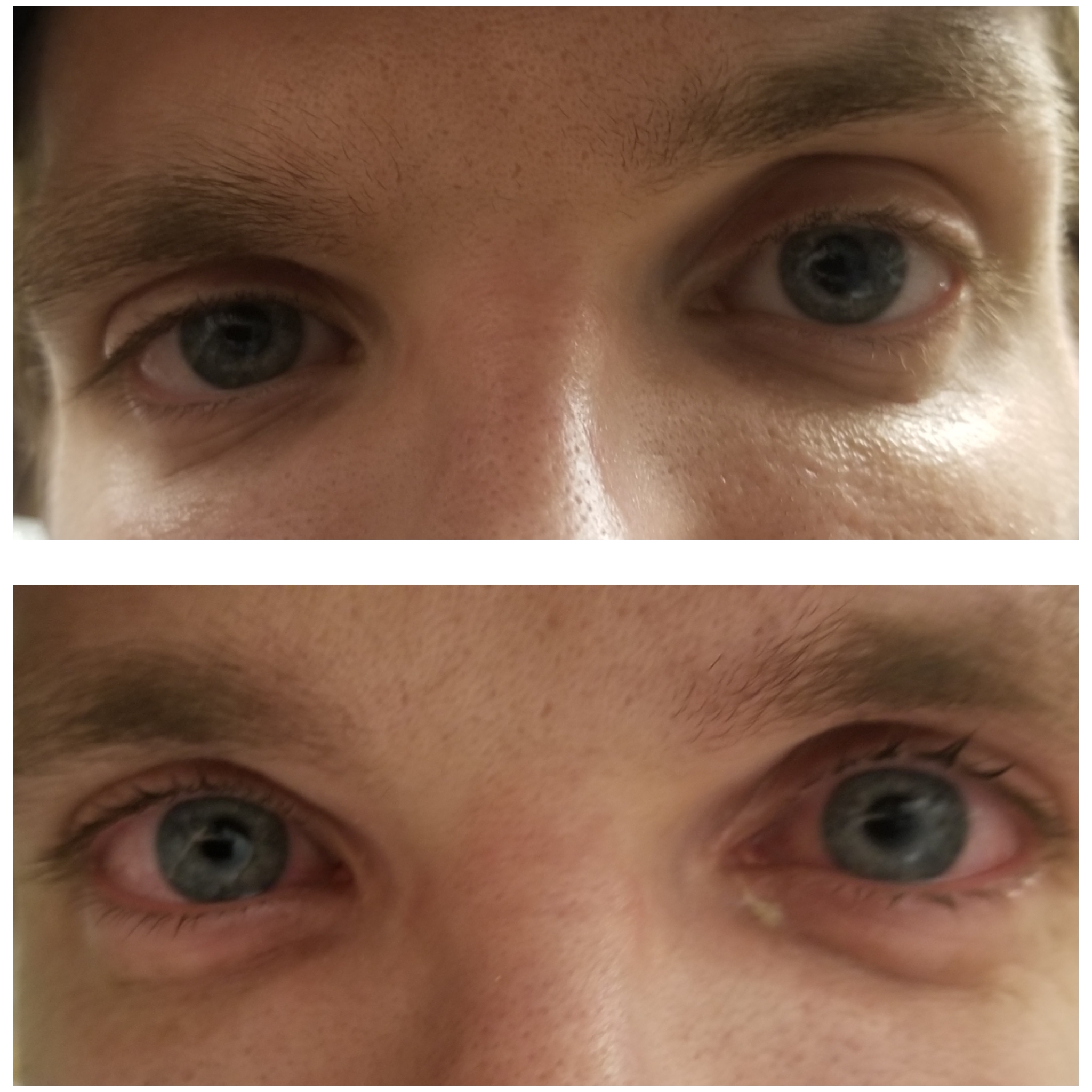 Before and after chopping 6 onions with a dull knife. Customer asked if