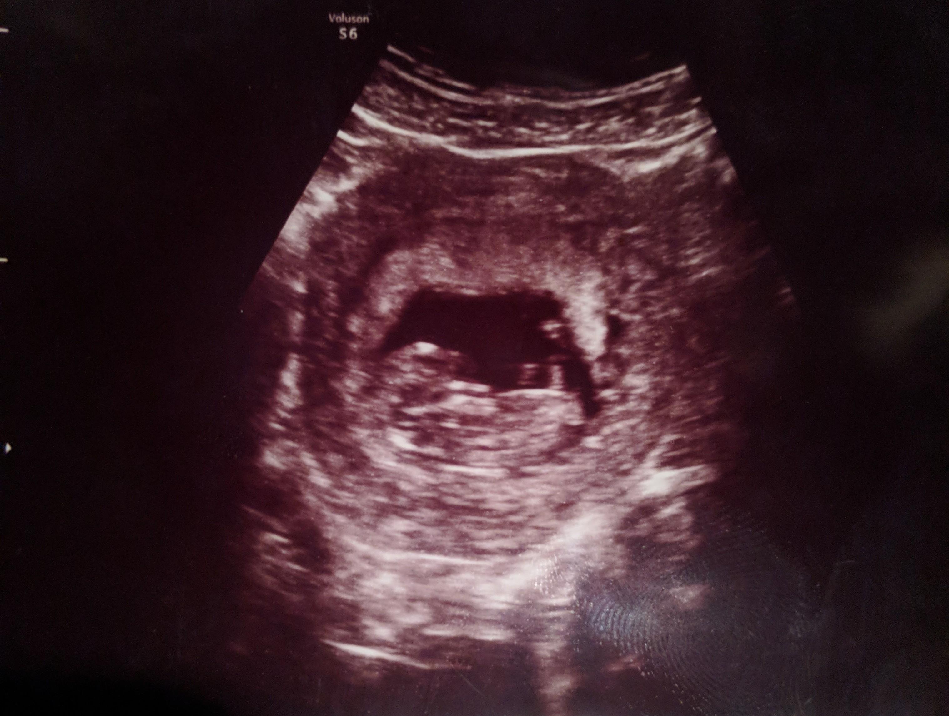 I had my first ultrasound today. I am currently 11 weeks and 4 days! His/her heartrate was 160