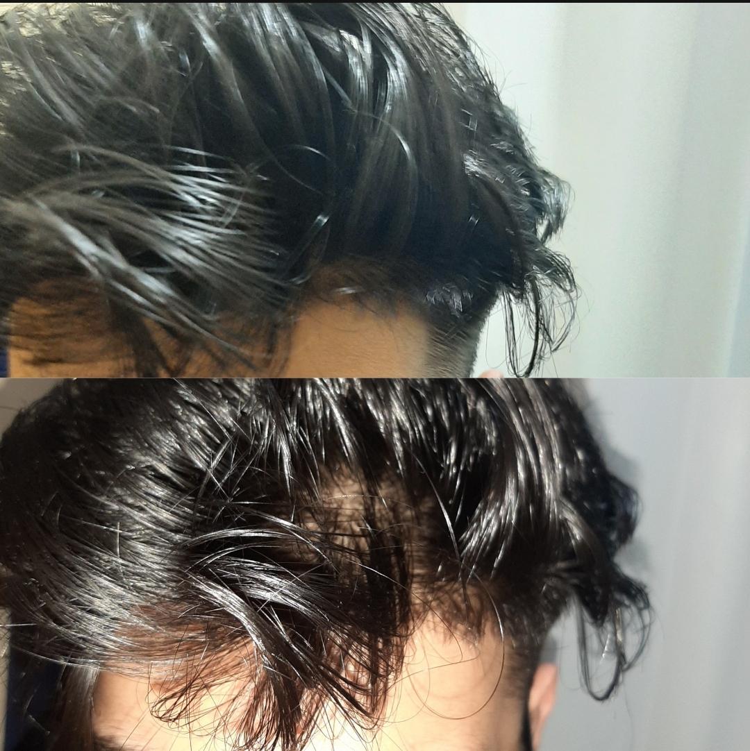 I can see my scalp through my hair under a direct strong light (flash