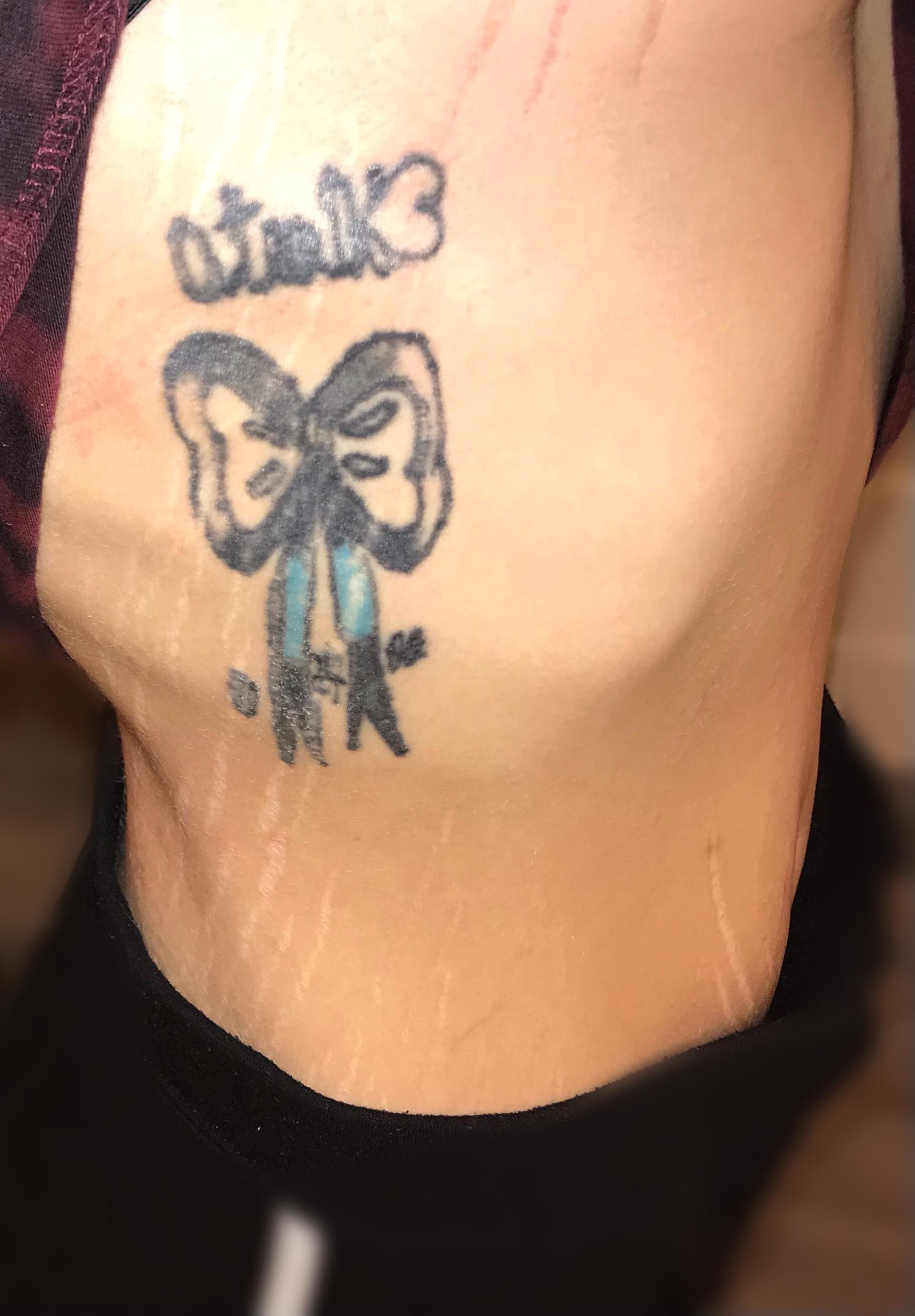 Does Anyone Have Any Suggestions On What Would Be Able To Cover Up The First Tattoo On My Rib Cage From When I Was 13? After Years Of Hard Work I Lost 2761_x_1919_jpg