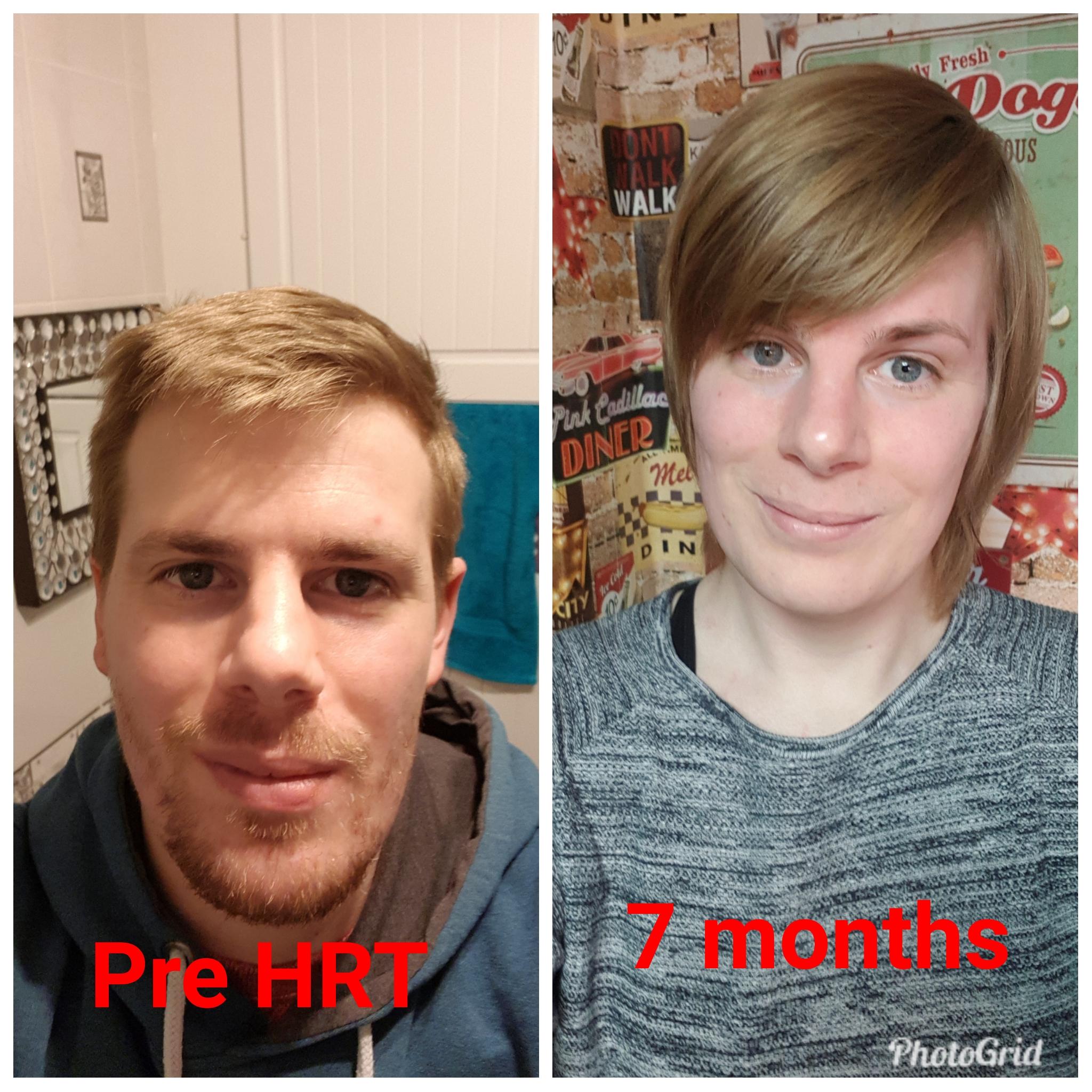 Could never grow my facial hair lol and I still suck at selfies