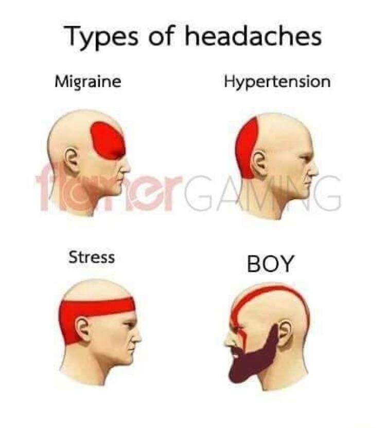 Headaches are the worst r/gaming