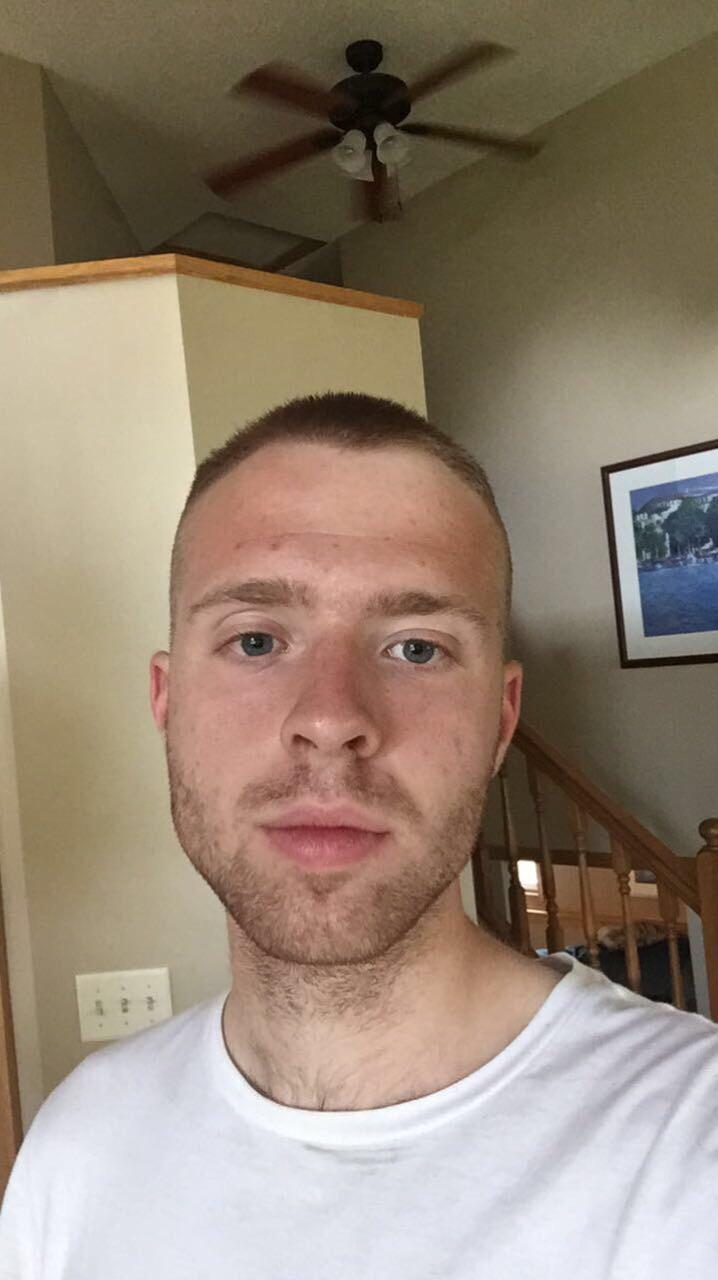 Does a buzz cut work for me? r/malehairadvice