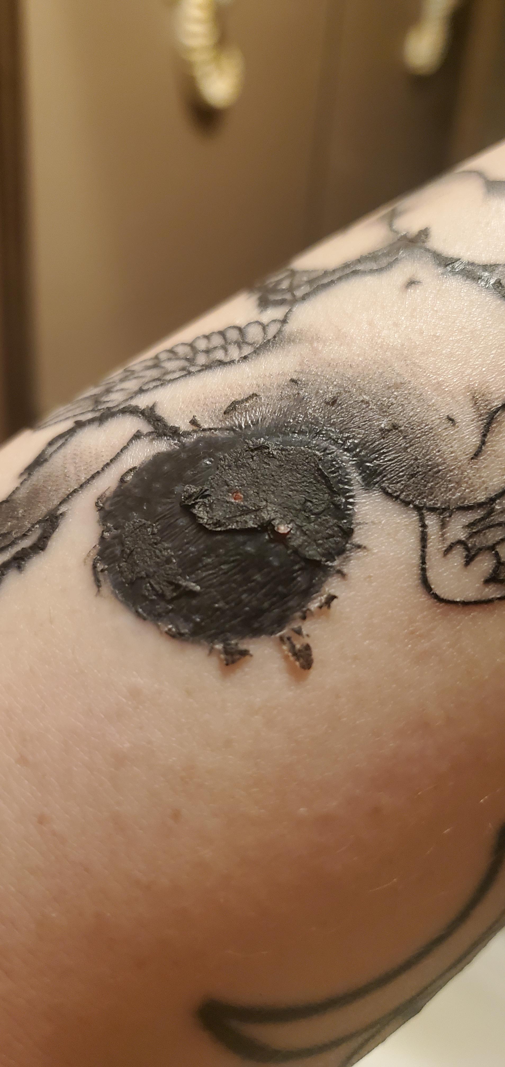 Little white spots under scab layer is this normal? Is it just skin