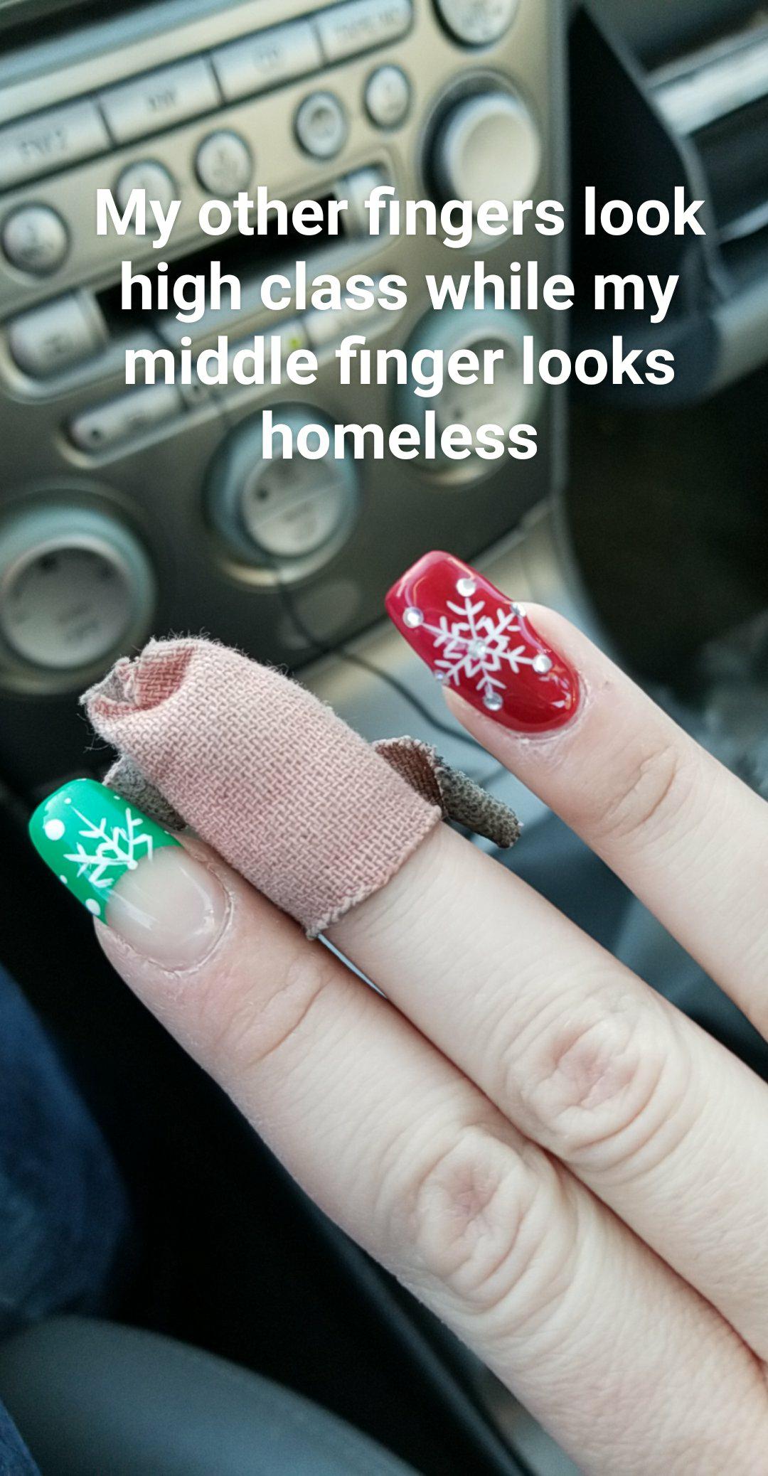 Hurt my finger at work today r/funny