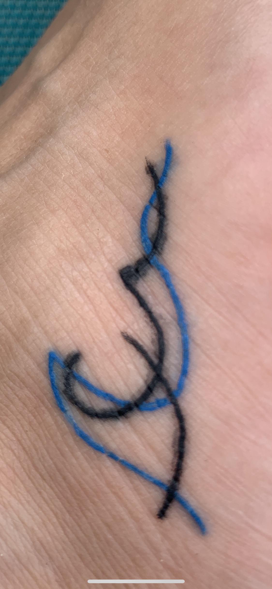 Help!! Tattoo blowout? Went swimming for an hour 2 weeks after getting