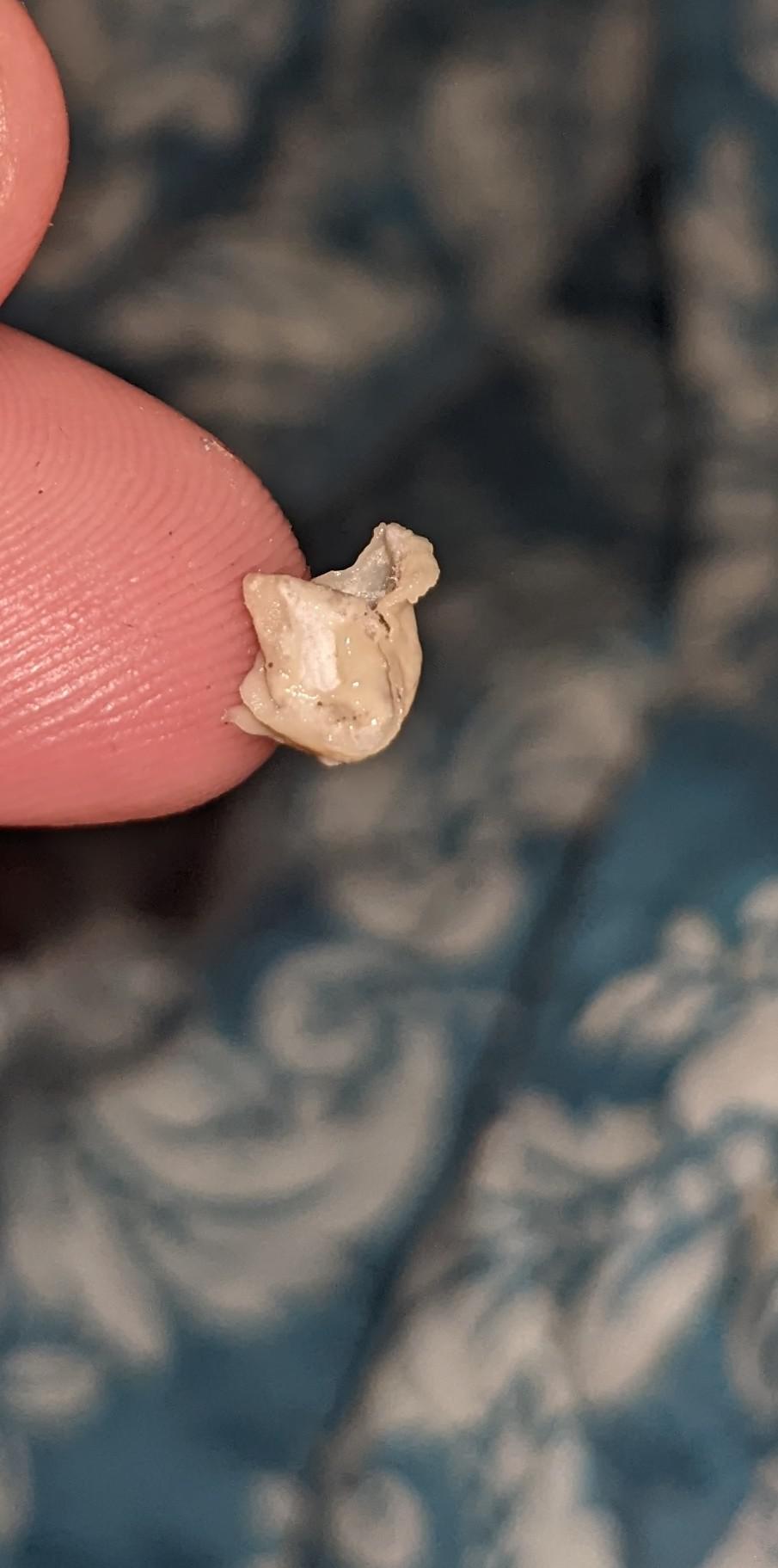 This came out of my ear with the help of a bobby pin???? earwax