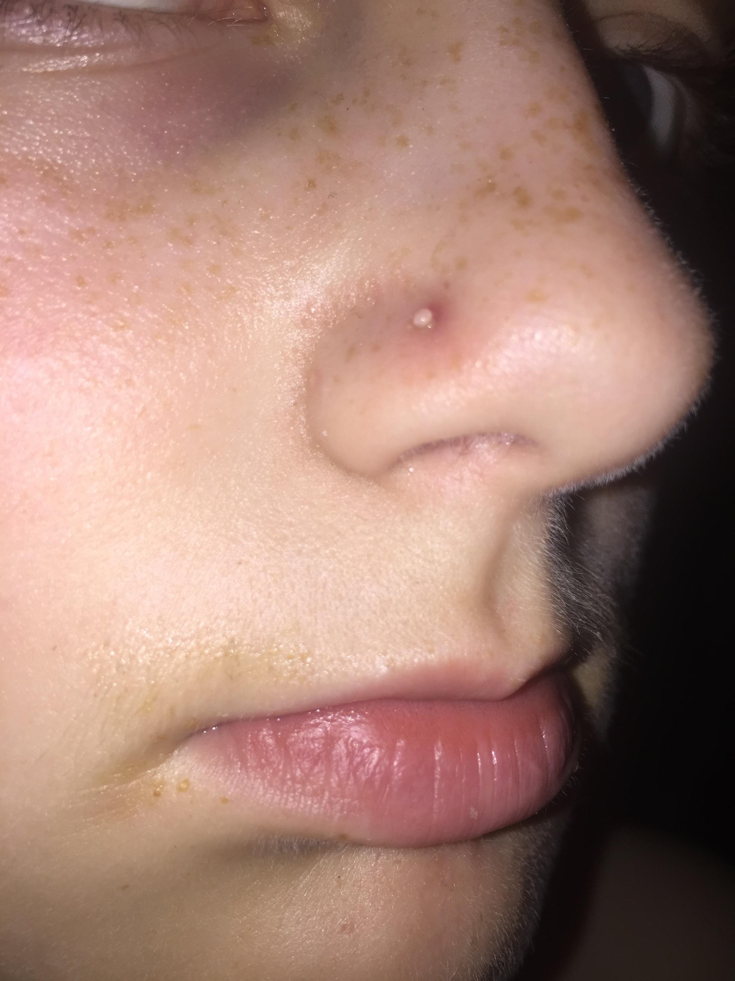 Understand and buy sore nose piercing> OFF73