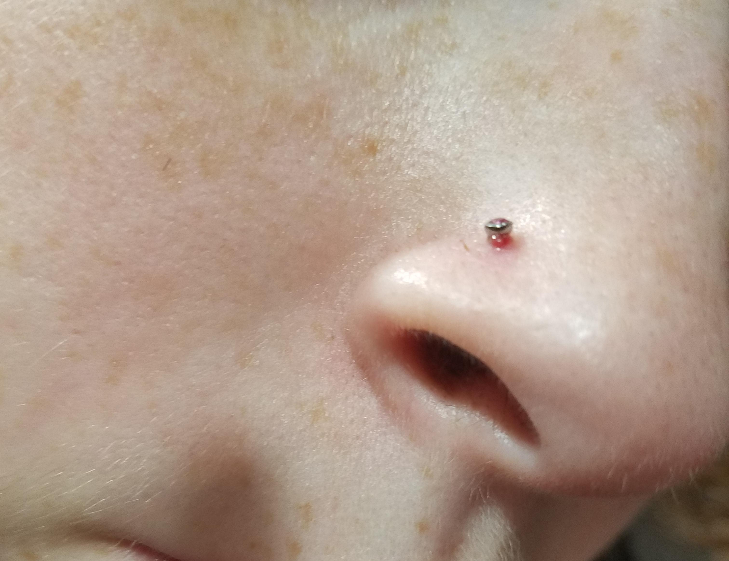 Nose piercing bump!! Help! I got it done 6 weeks ago and it was healing