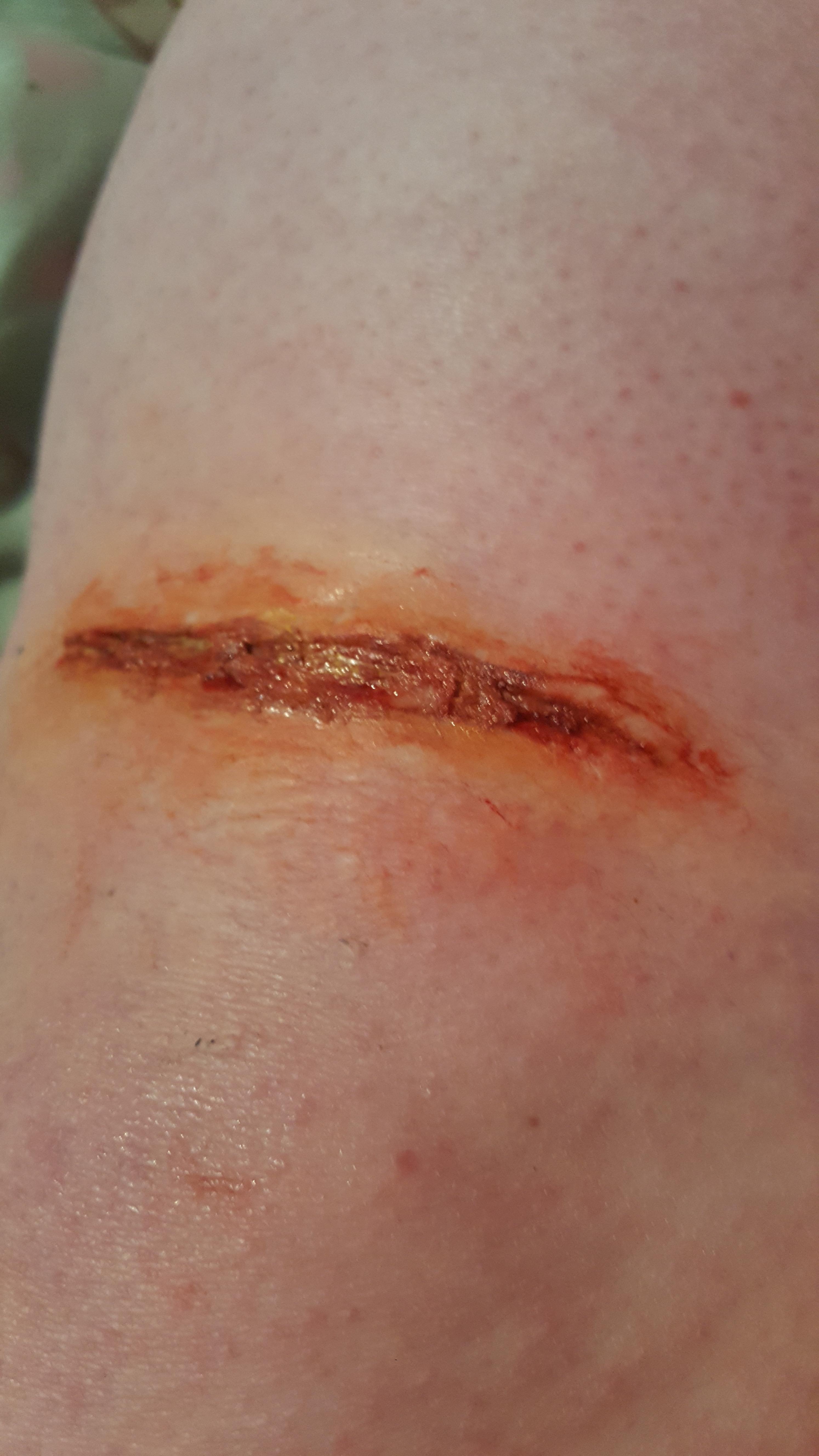 A simple infected leg wound I created using scar wax! If anyone has any
