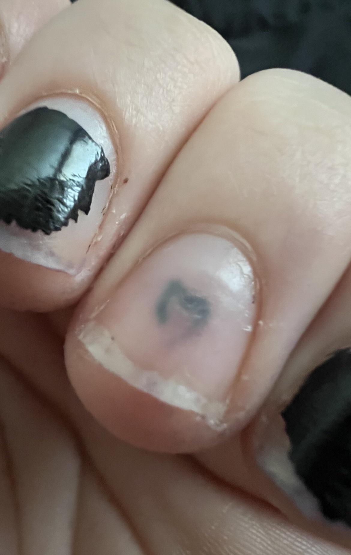 Healed nail bed tattoo by Henry Kaufman (Lucky Gal in Des Moines) r