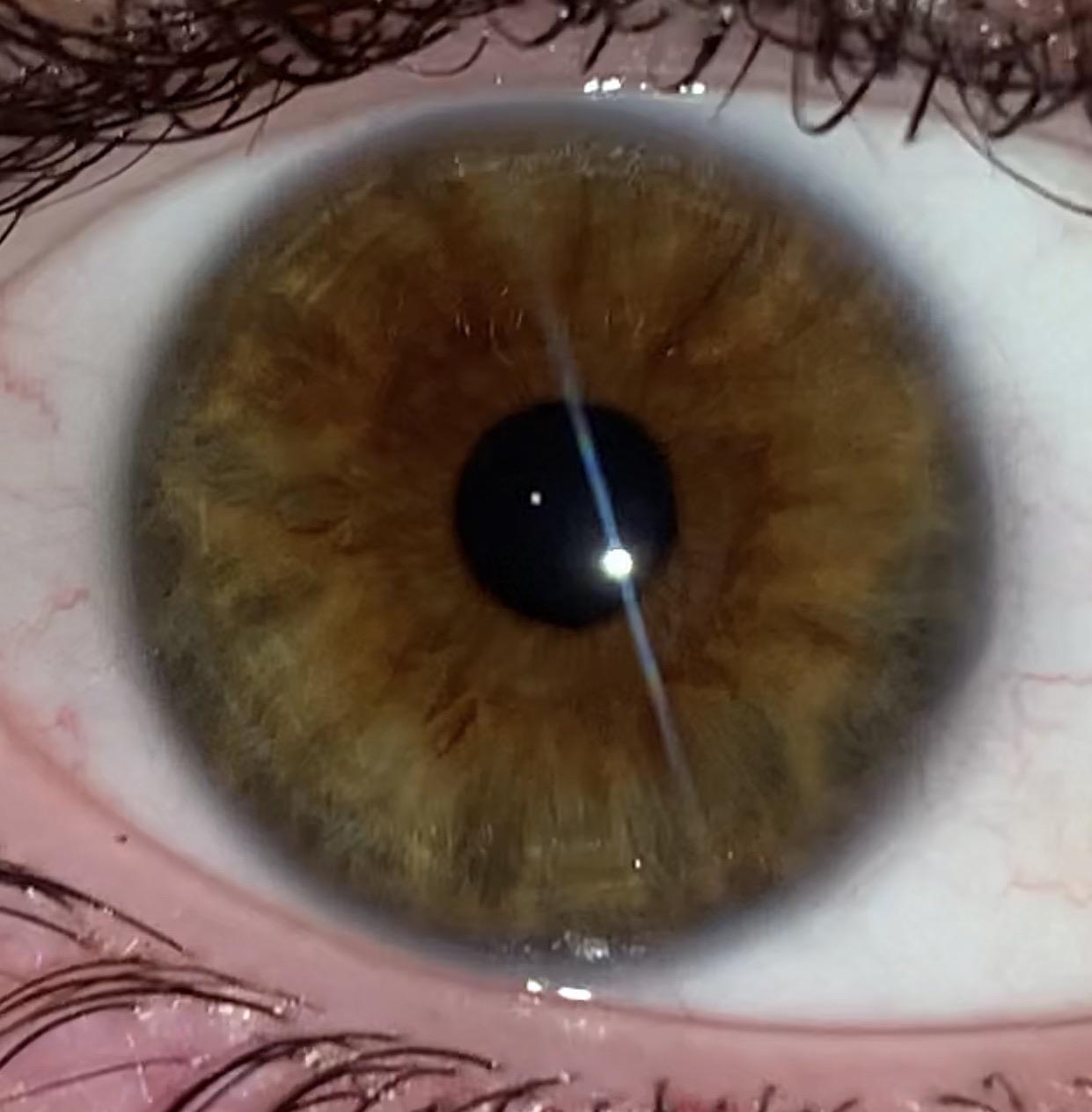 Hazel vs brown eyes westerngaret