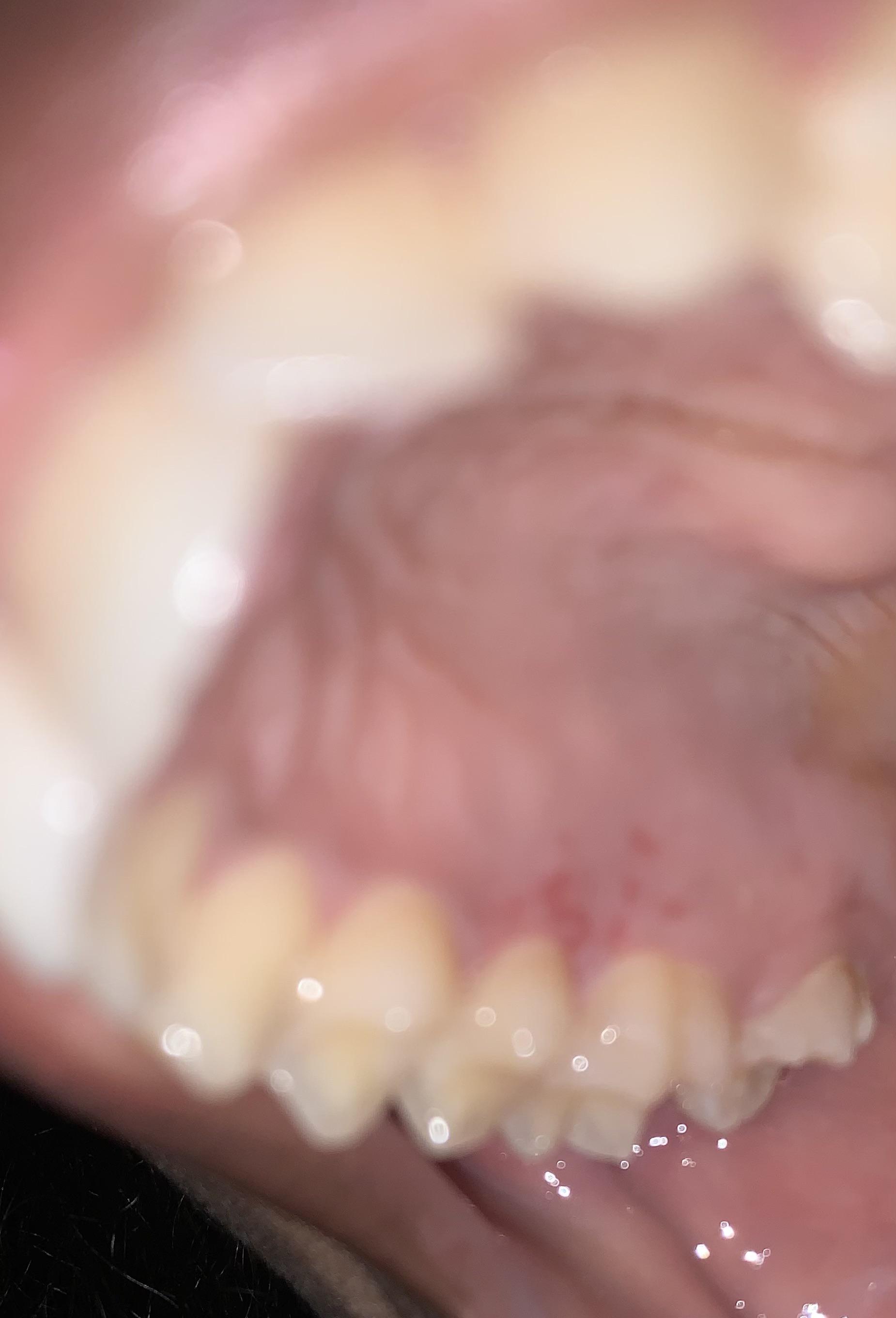 What are these spots on my gums? They generally came out of nowhere
