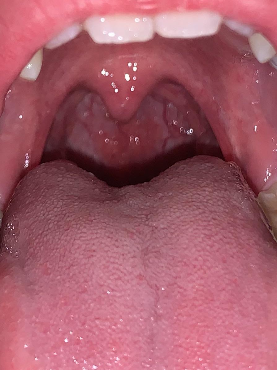 Anyone know what the two red bumps at the back could be? I’ve been