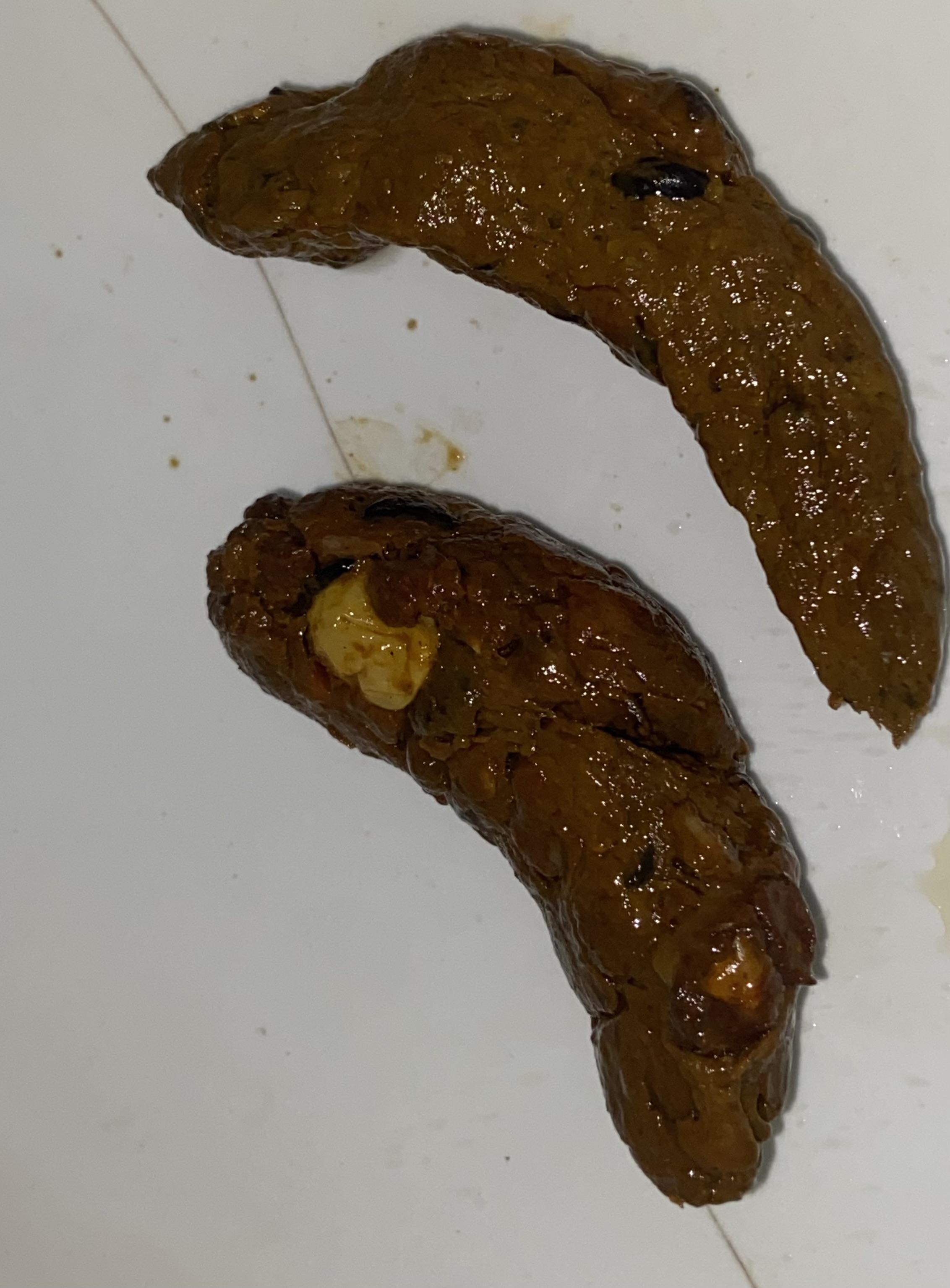 Strange things in my stool for a while, What causes this? And how to