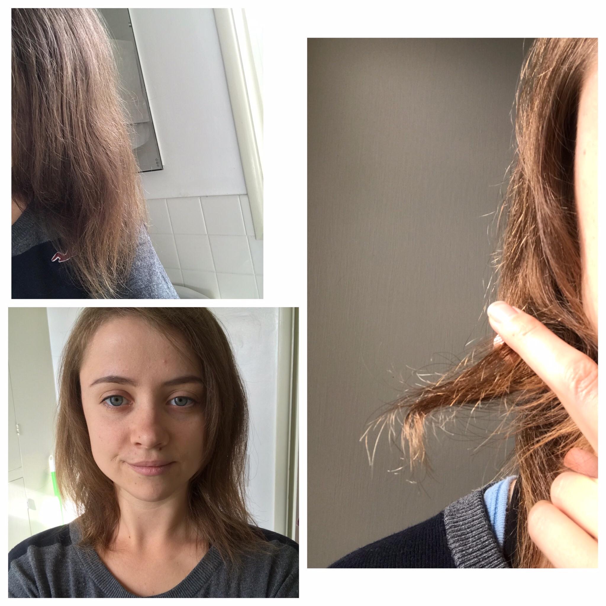 What to do with my dead hair? I don’t want to chop it all off