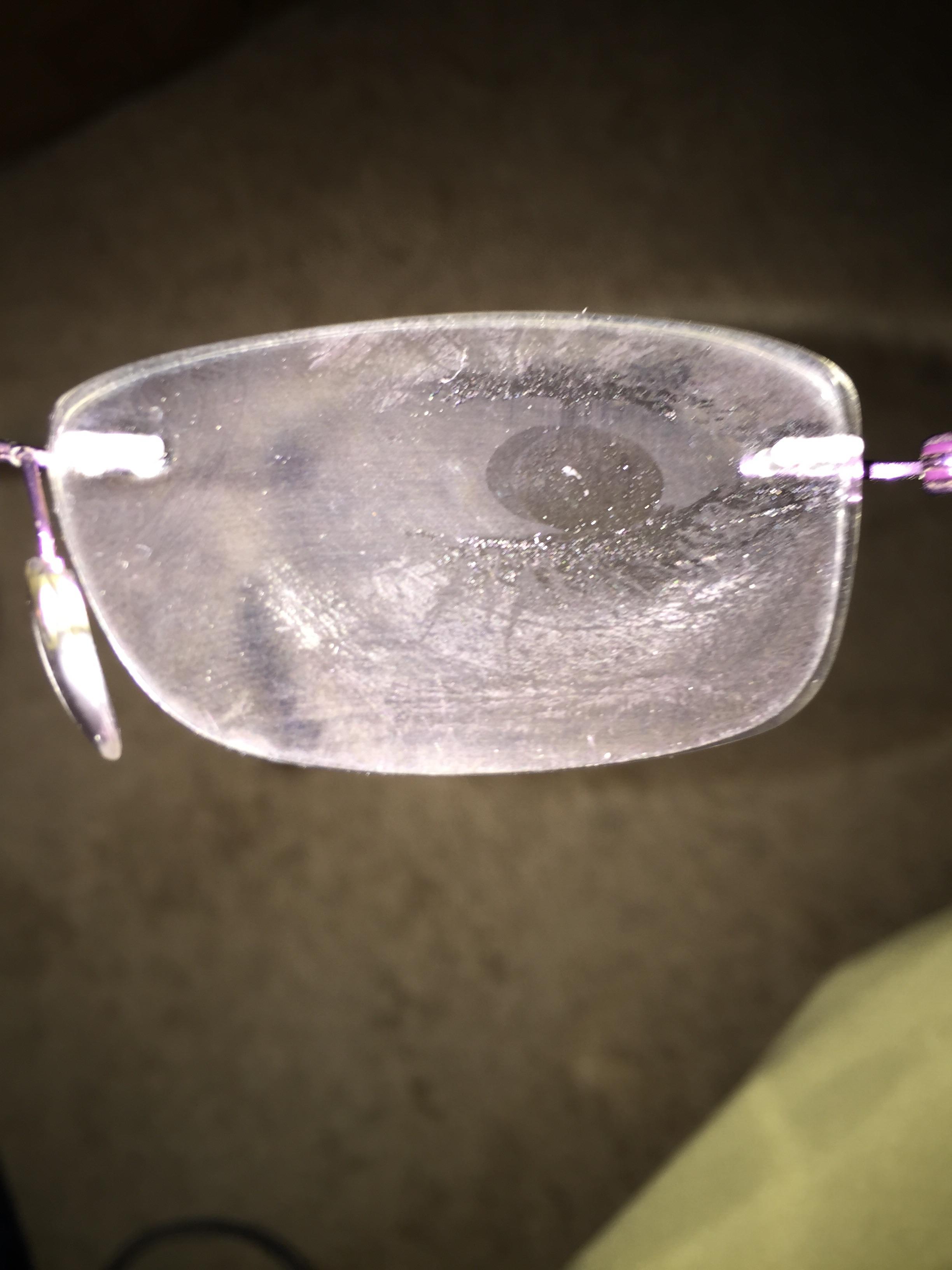This guy has a perfect imprint of his eye on his glasses r/pics