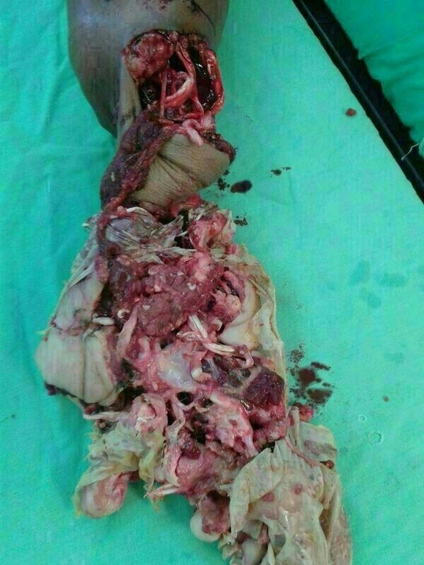 In case you’re wondering what the hand looks like after a battle with a