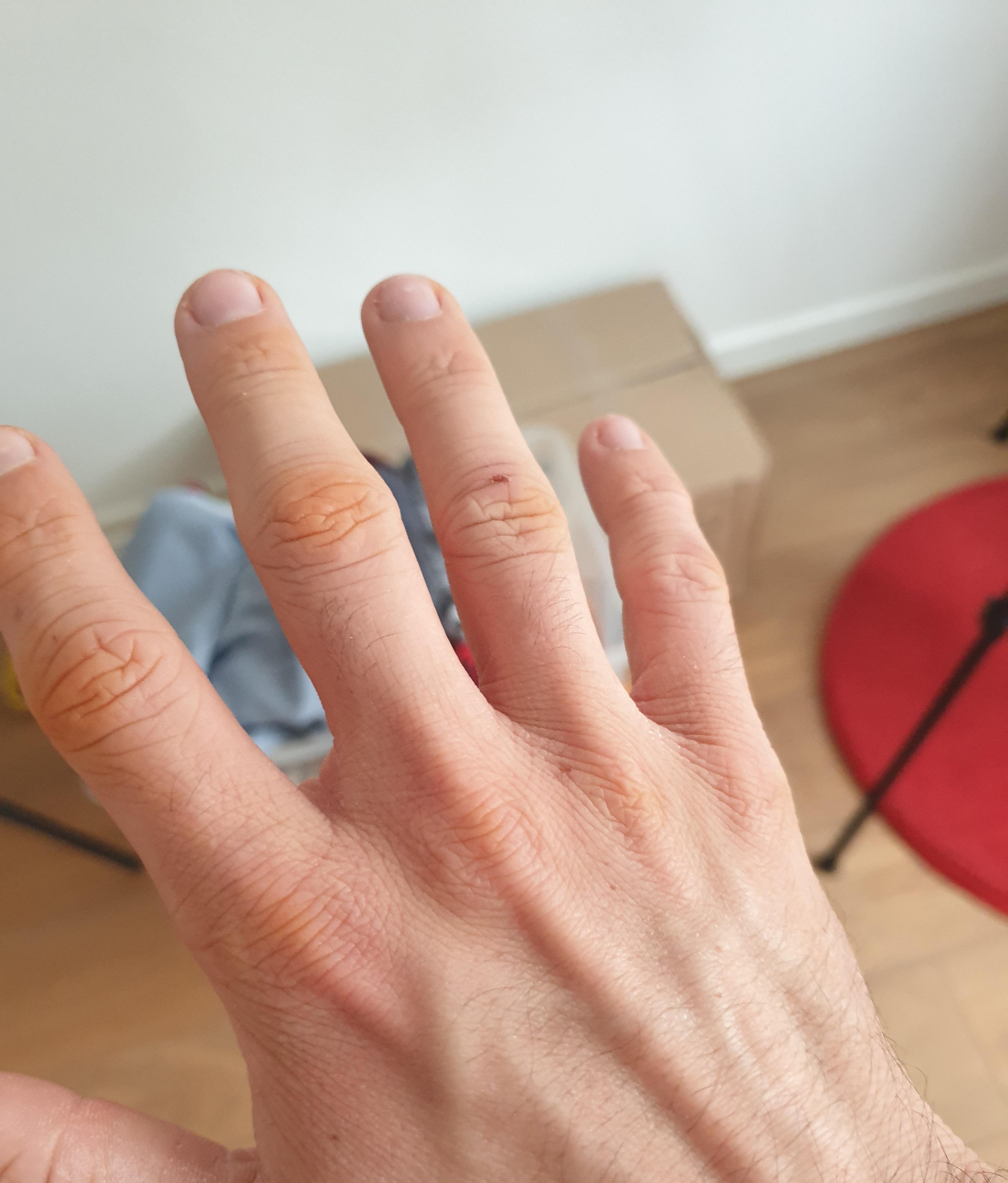 I lost my dad a couple days ago. what the doctors told me happened I