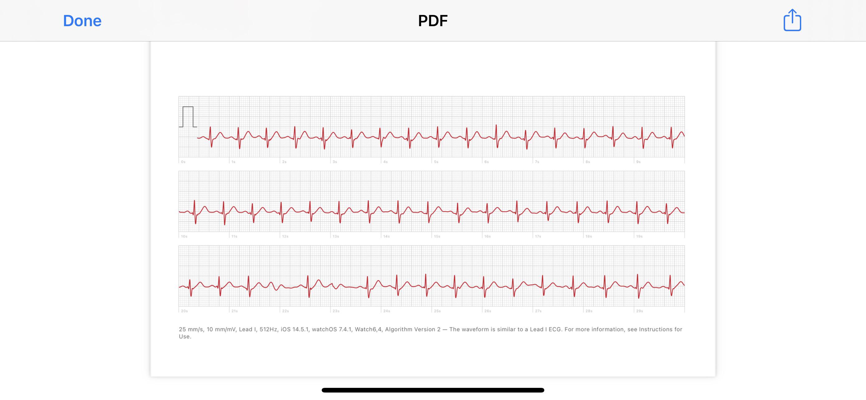 Are these just PVCs? They look very different from my usual ones r