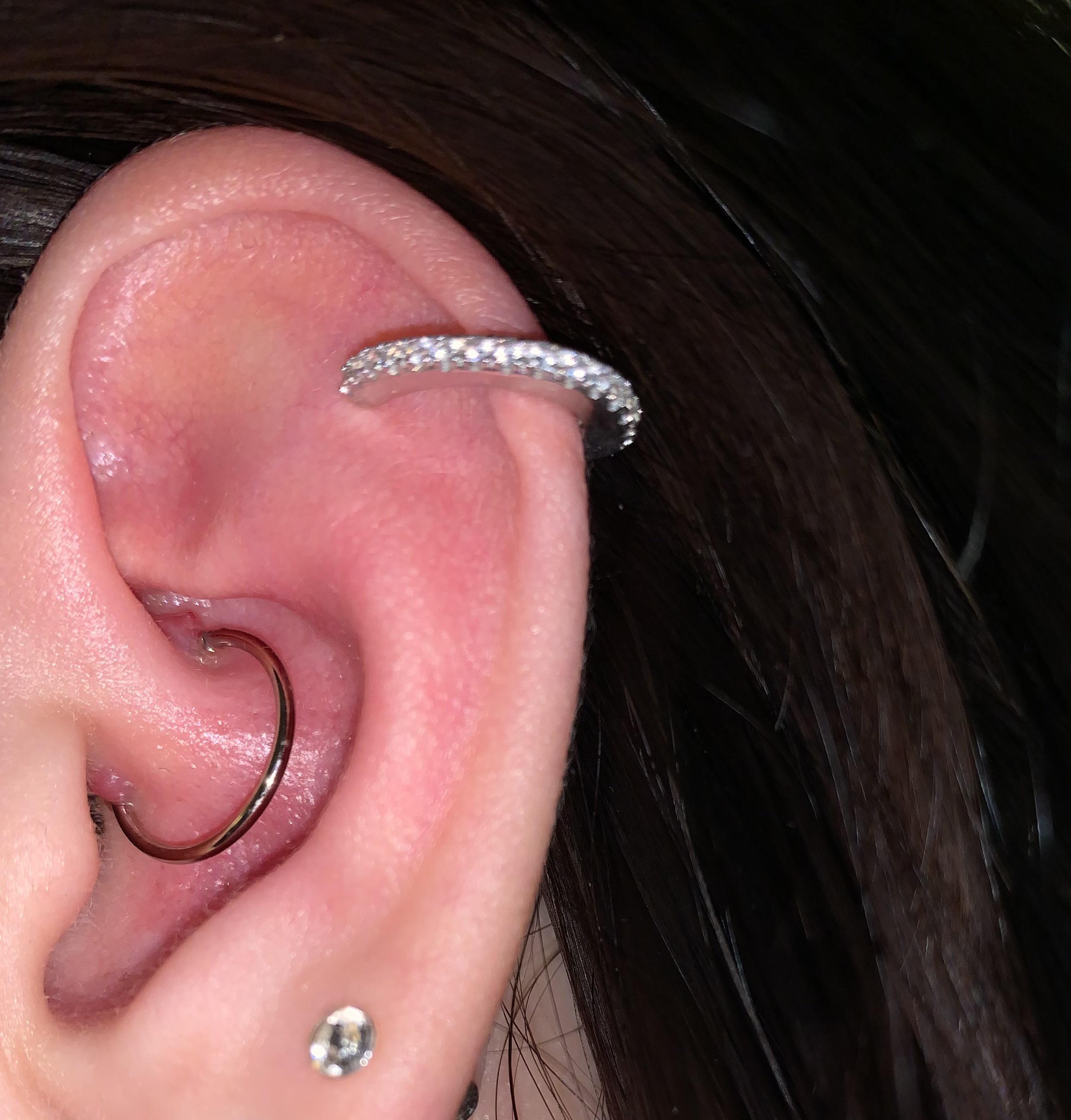HELP Piercing bump on daith piercing. Got it pierced 4 weeks ago and