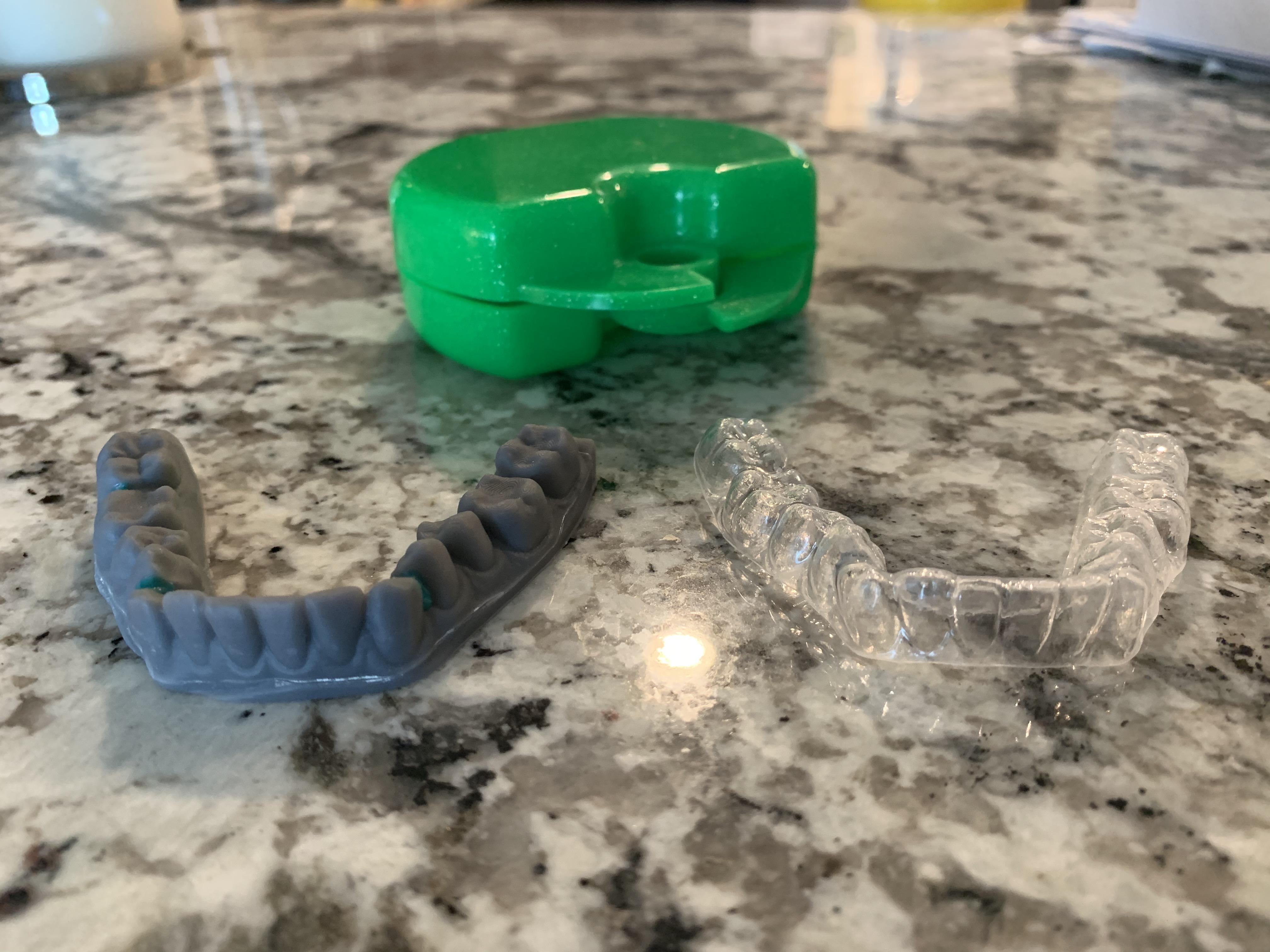 My new retainer came with a 3D printed mold of my teeth mildlyinteresting