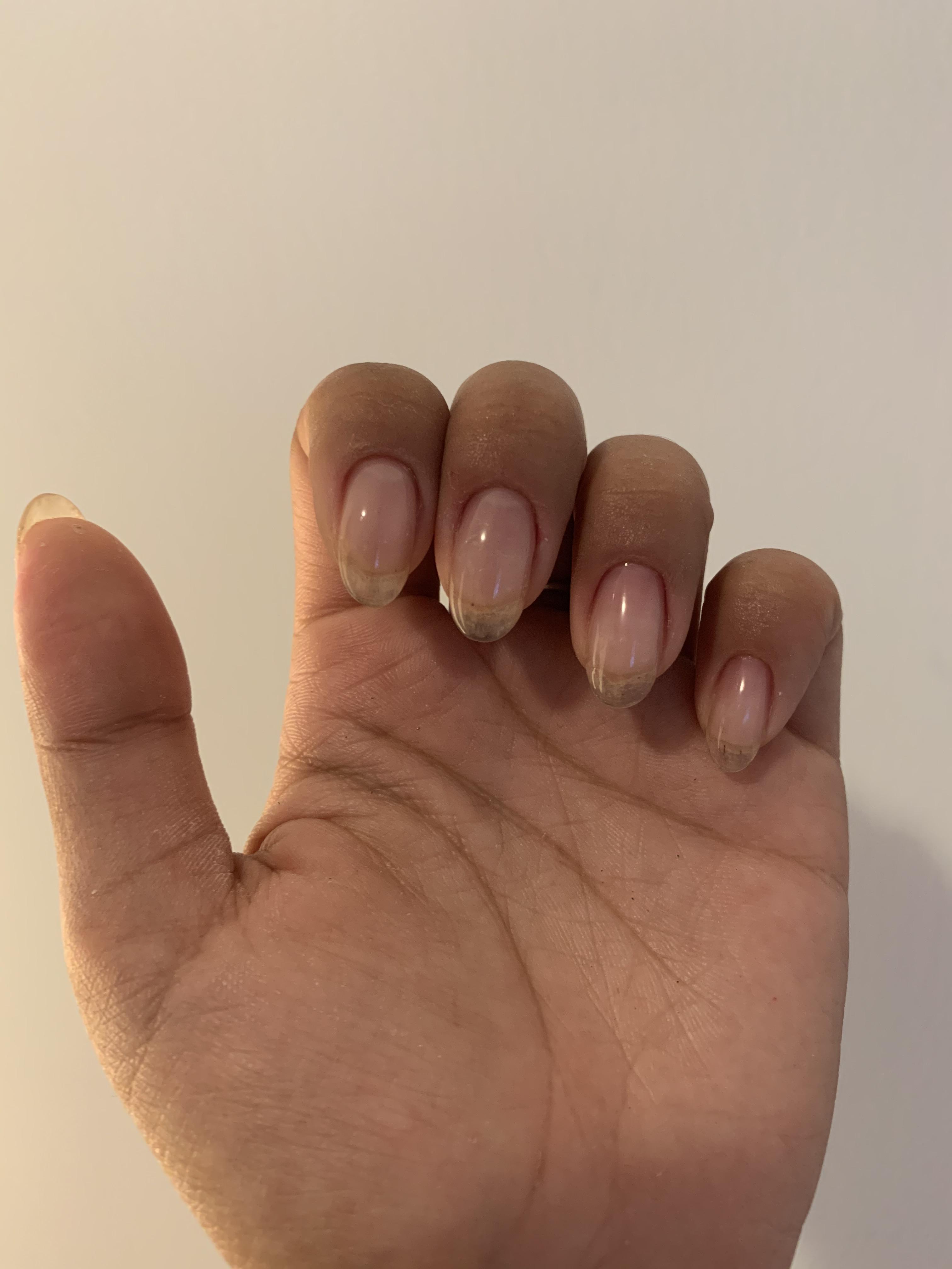 I quit biting my nails on January 2. My nails used to be half this