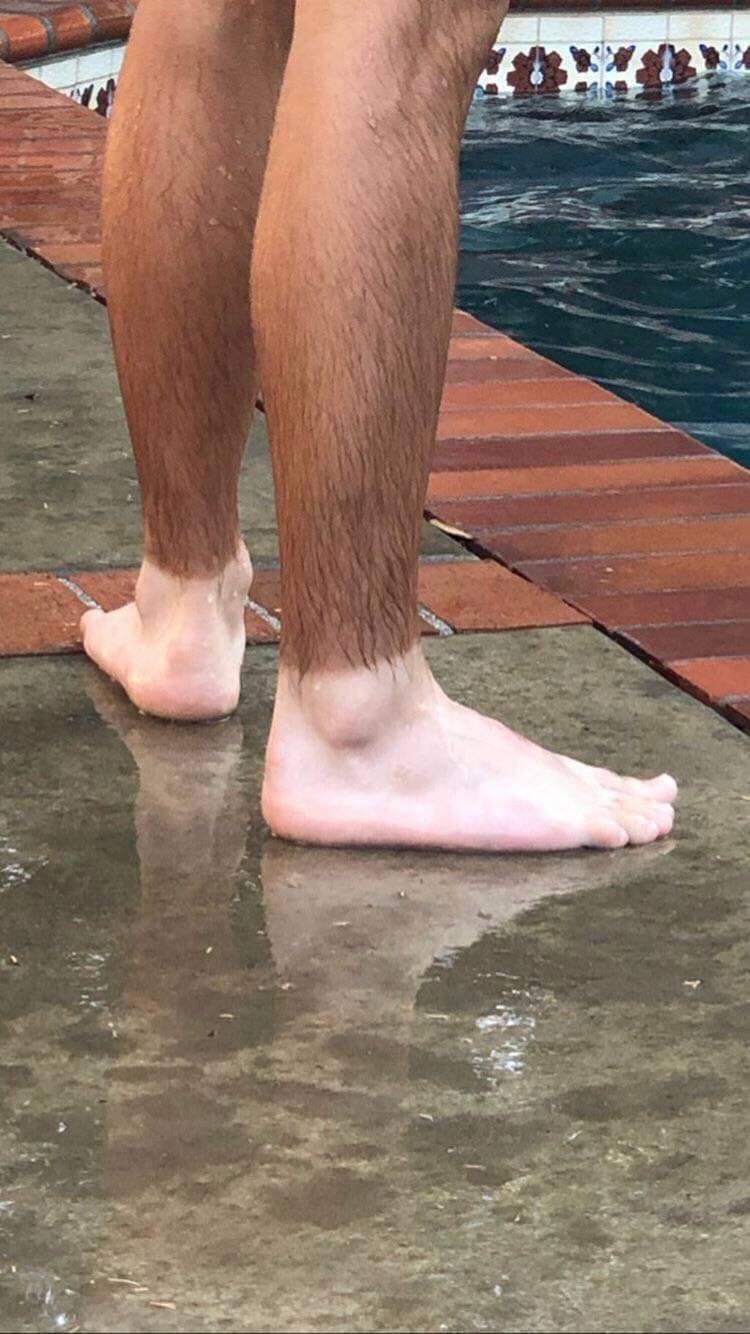 This guy his feet r/awfuleverything