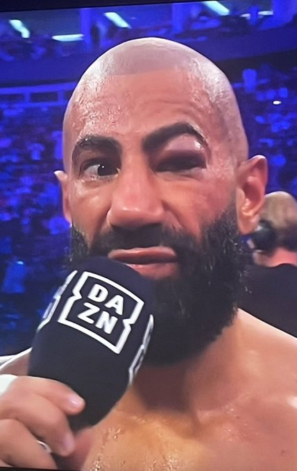 One eye open when I'm sleeping W2S