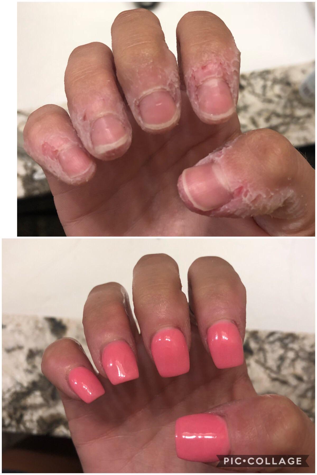 2 months progress ) dip powder helped my nails grow and I am slowly