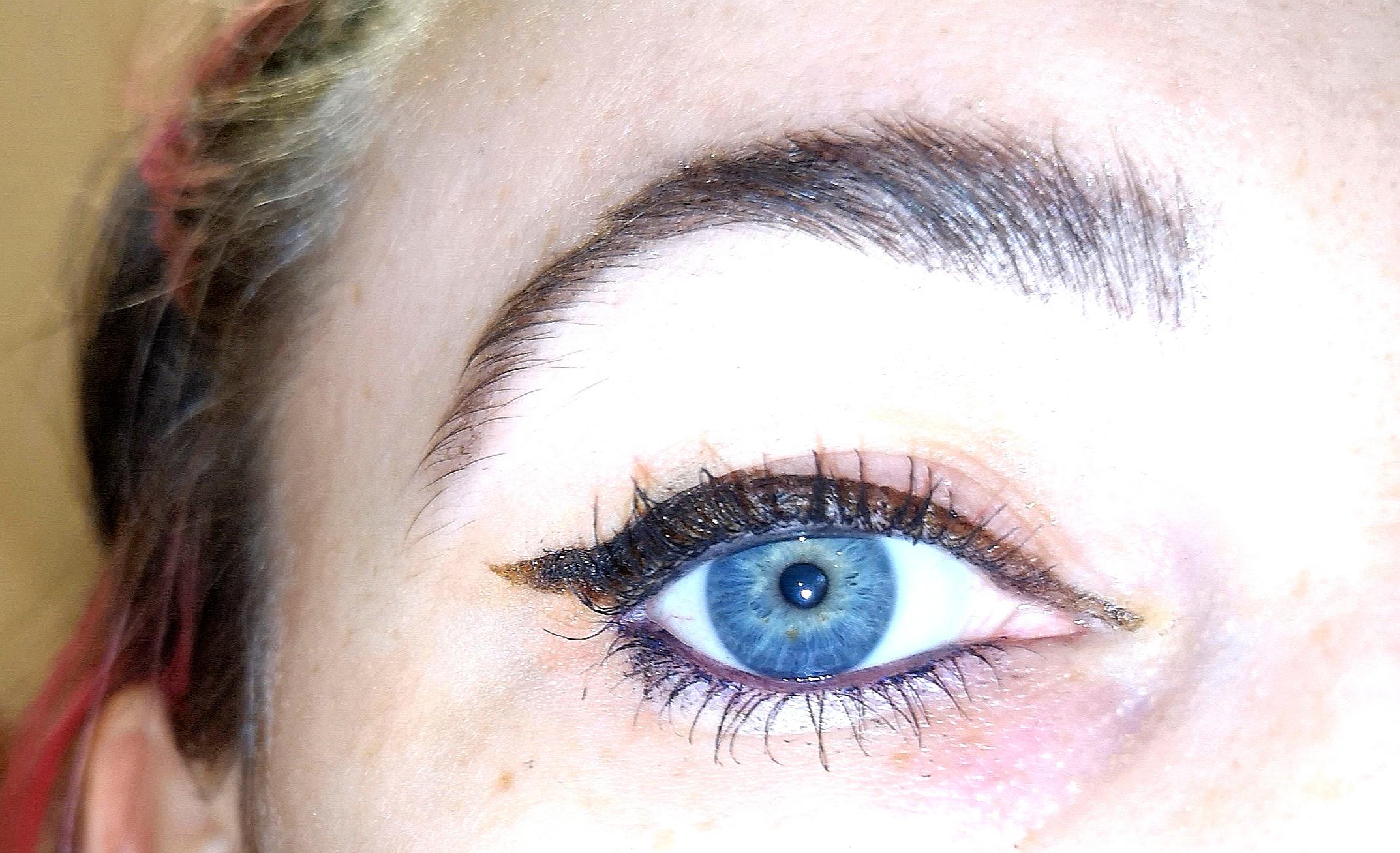 I have central heterochromia... Yellow around the pupil and the rest is